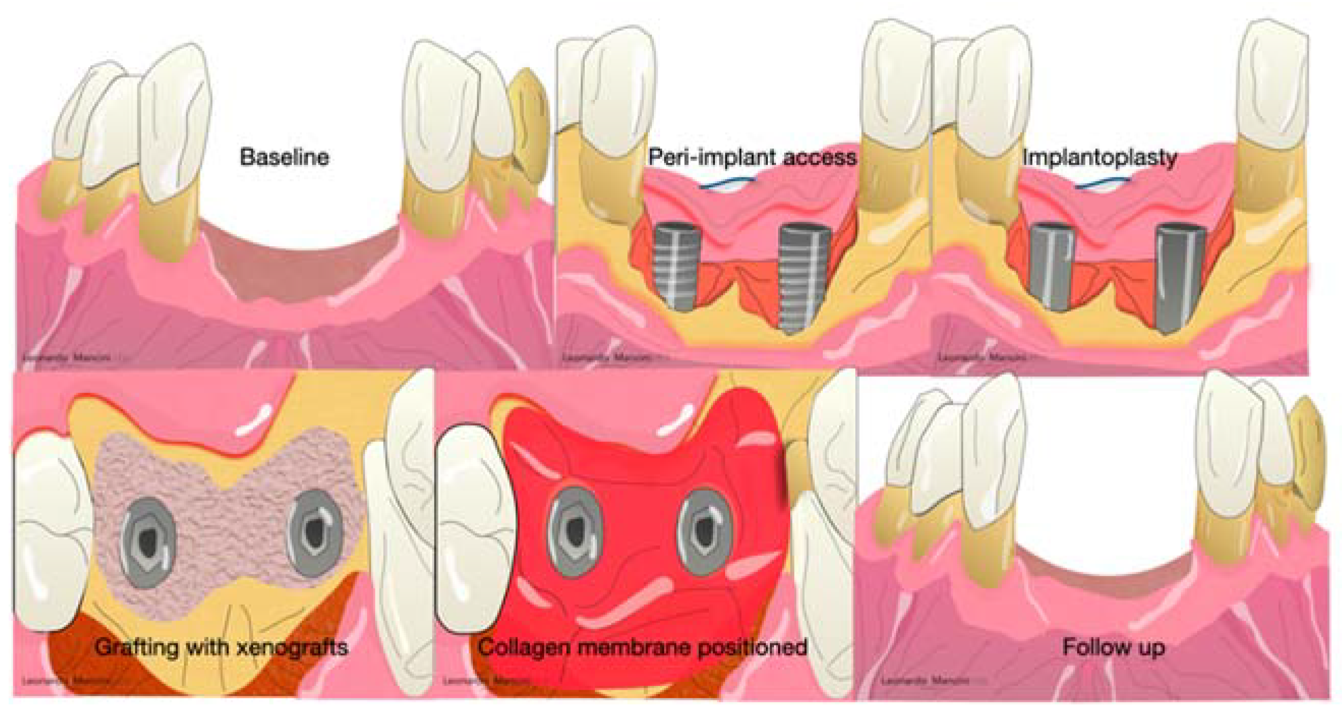 Materials 14 03319 g006 Materials 14 03319 g006