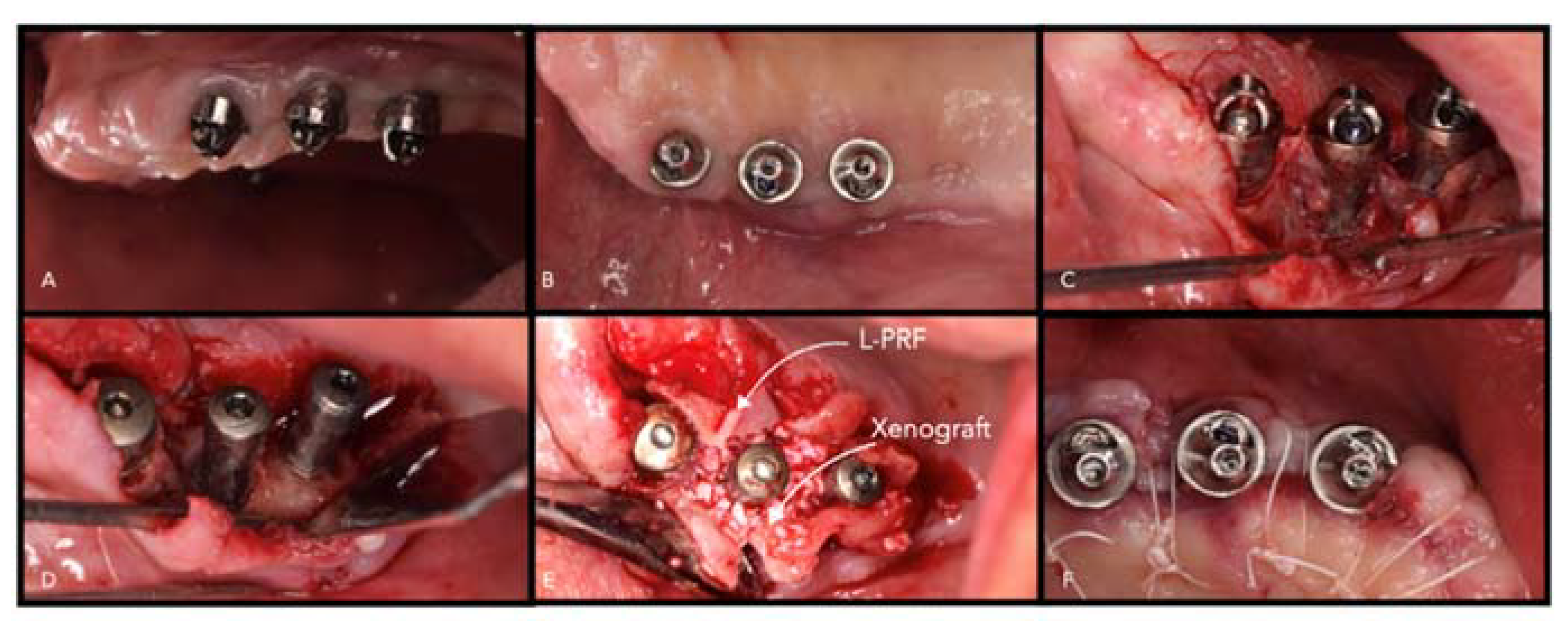 Materials 14 03319 g008 Materials 14 03319 g008