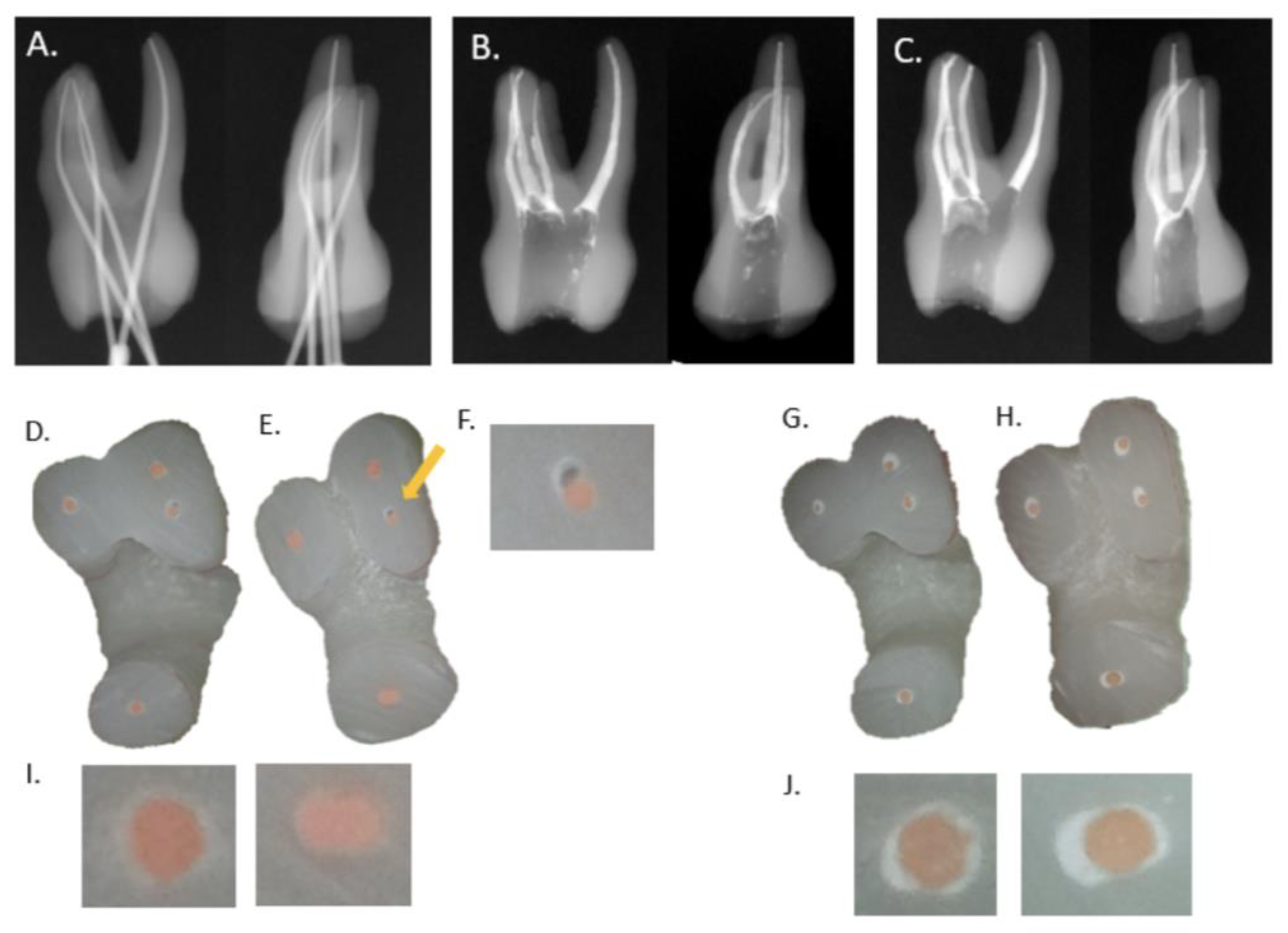 Materials Free FullText Volume Percentage of Filling Voids in Root