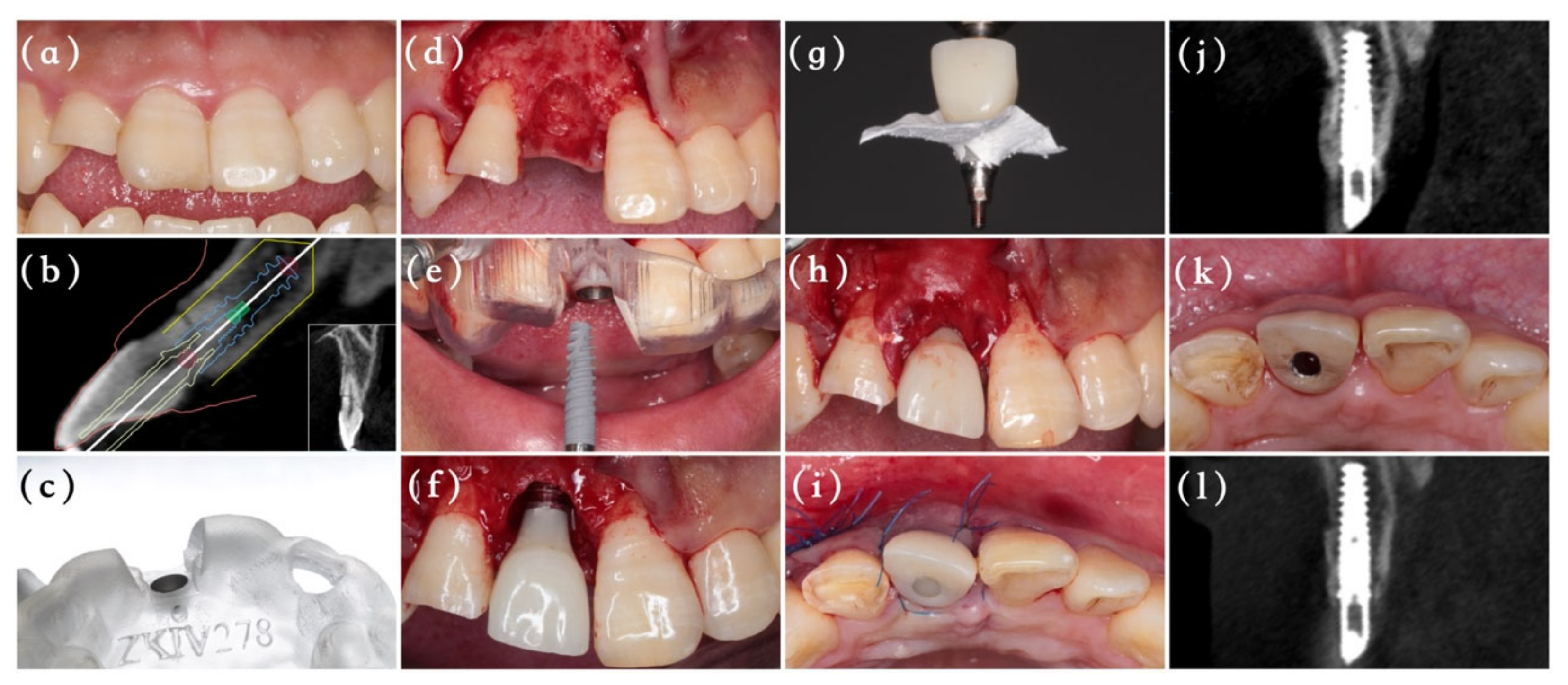 Materials 14 03874 g001