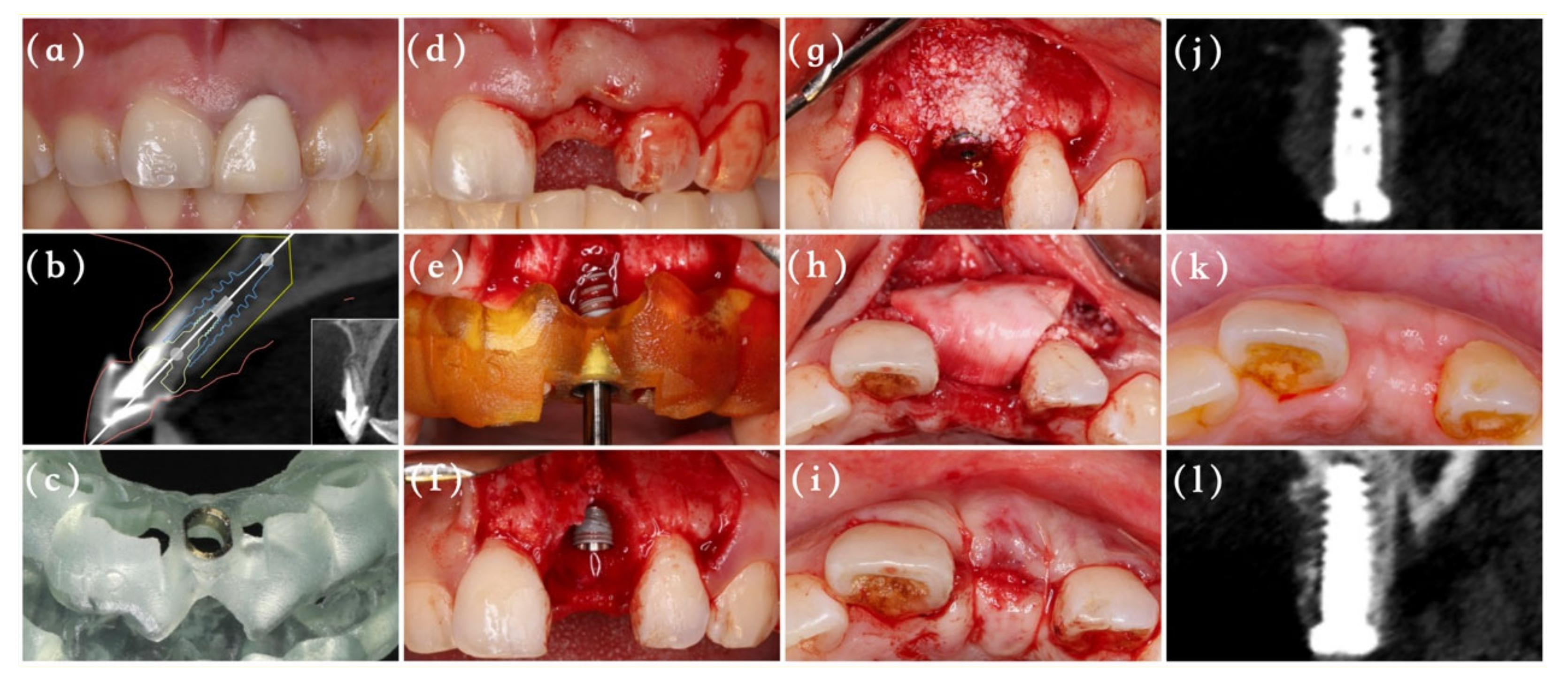 Materials 14 03874 g002