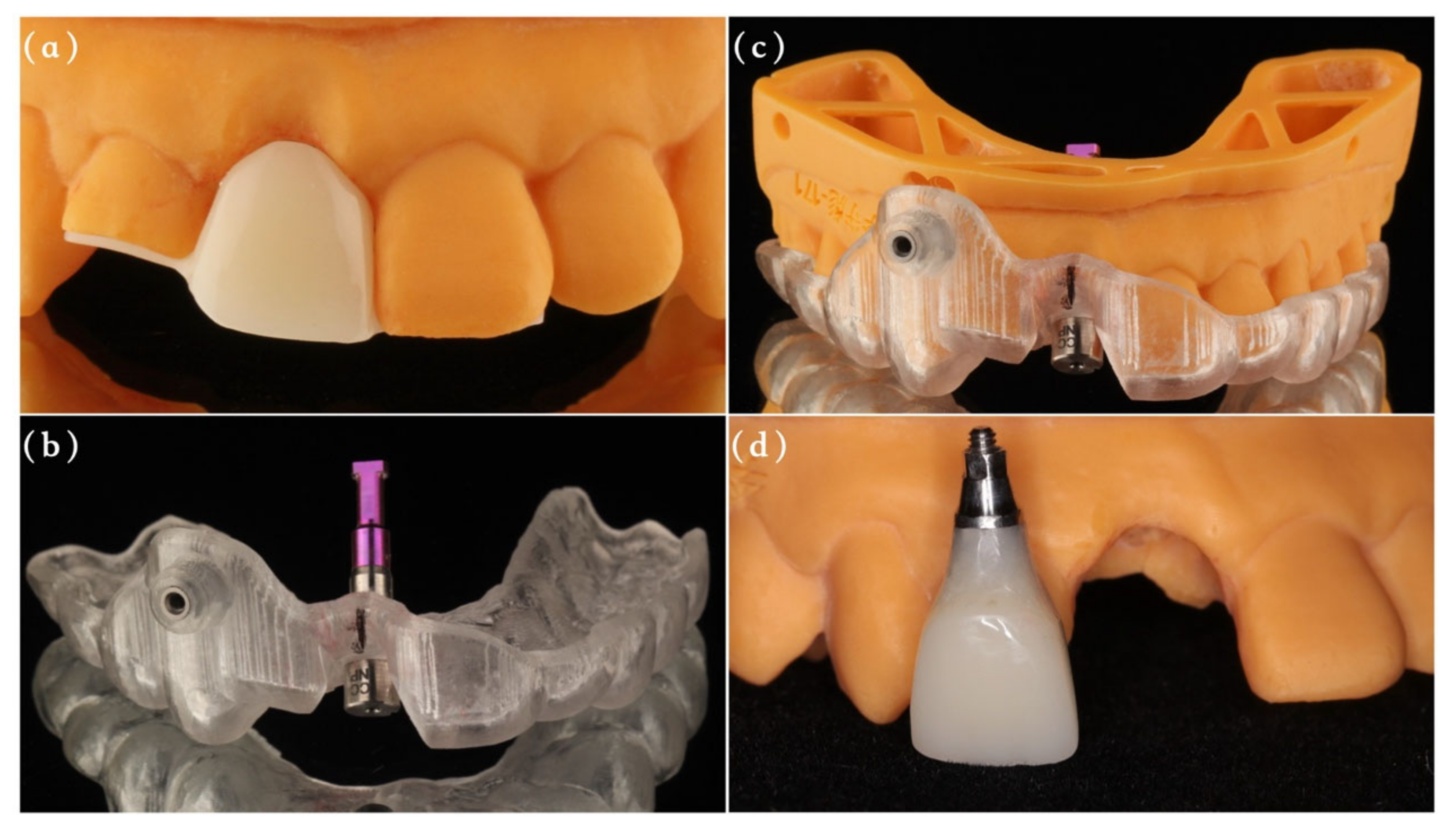 Materials 14 03874 g003