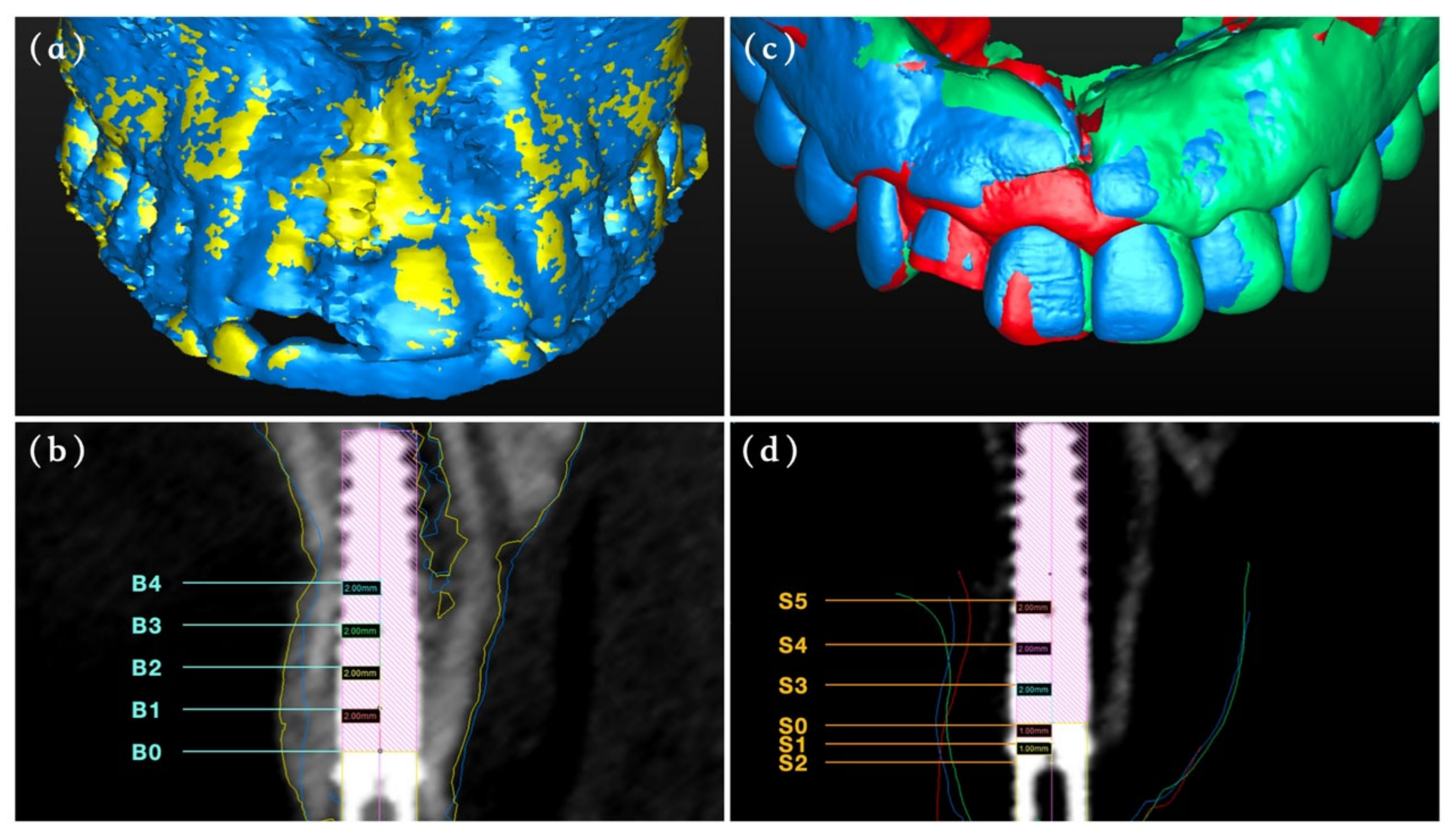 Materials 14 03874 g004