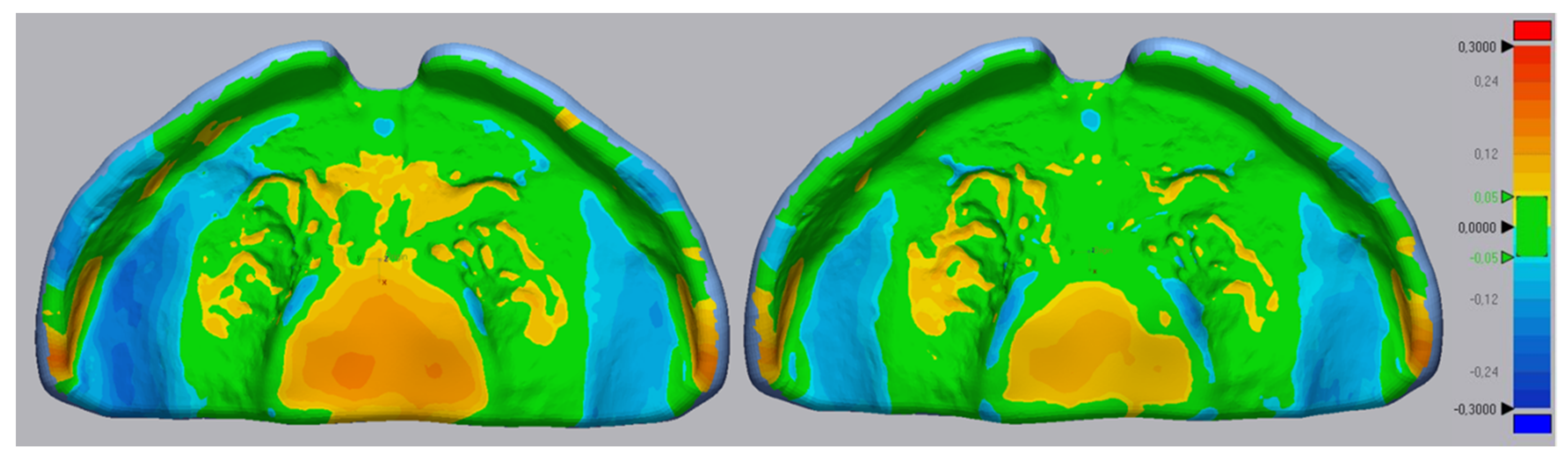 Materials Free Full Text Accuracy Evaluation Of Additively And Subtractively Fabricated Palatal Plate Orthodontic Appliances For Newborns And Infants An In Vitro Study Html Materials Free Full Text Accuracy Evaluation Of Additively And Subtractively Fabricated Palatal Plate Orthodontic Appliances For Newborns And Infants An In Vitro Study Html