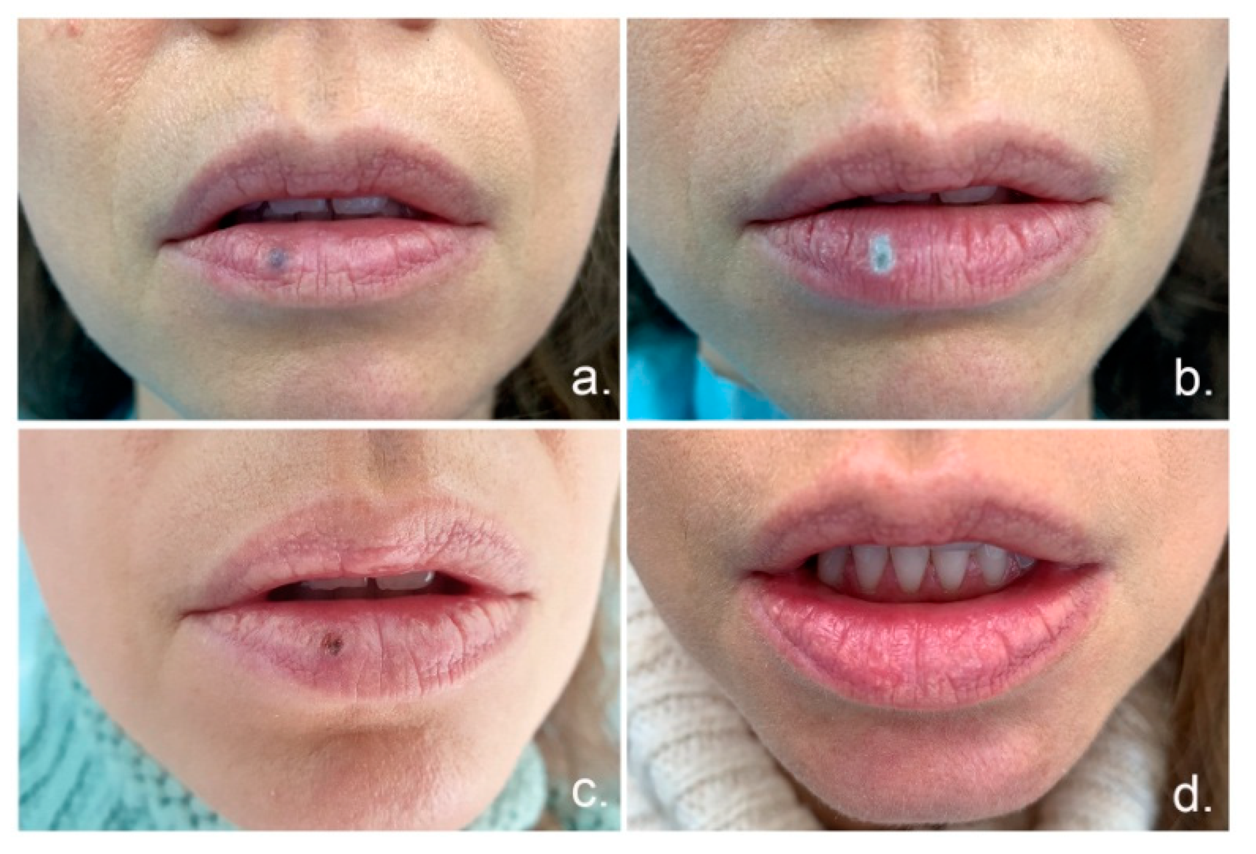 Materials 14 04140 g002 550