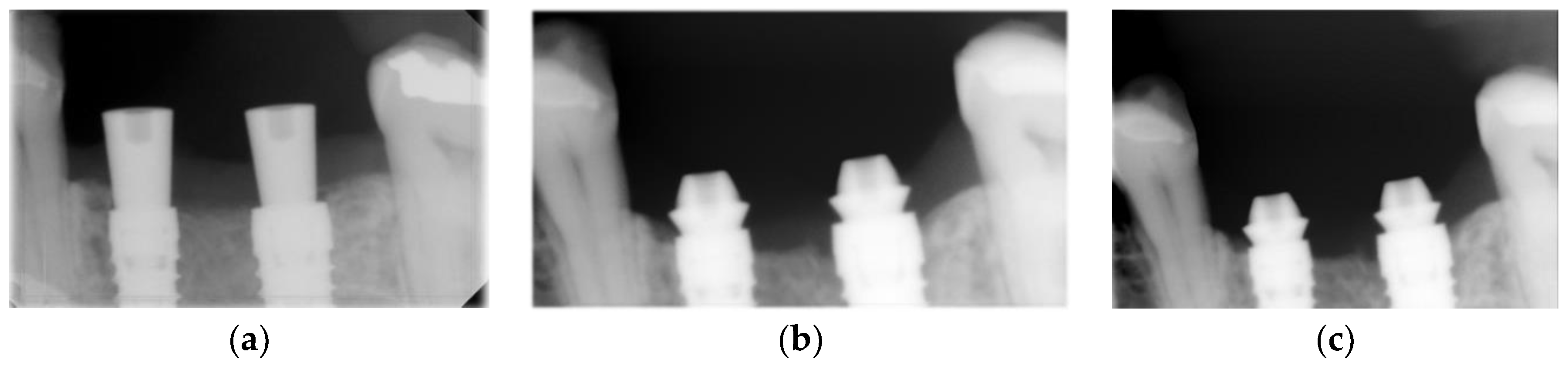 Materials 14 04179 g003