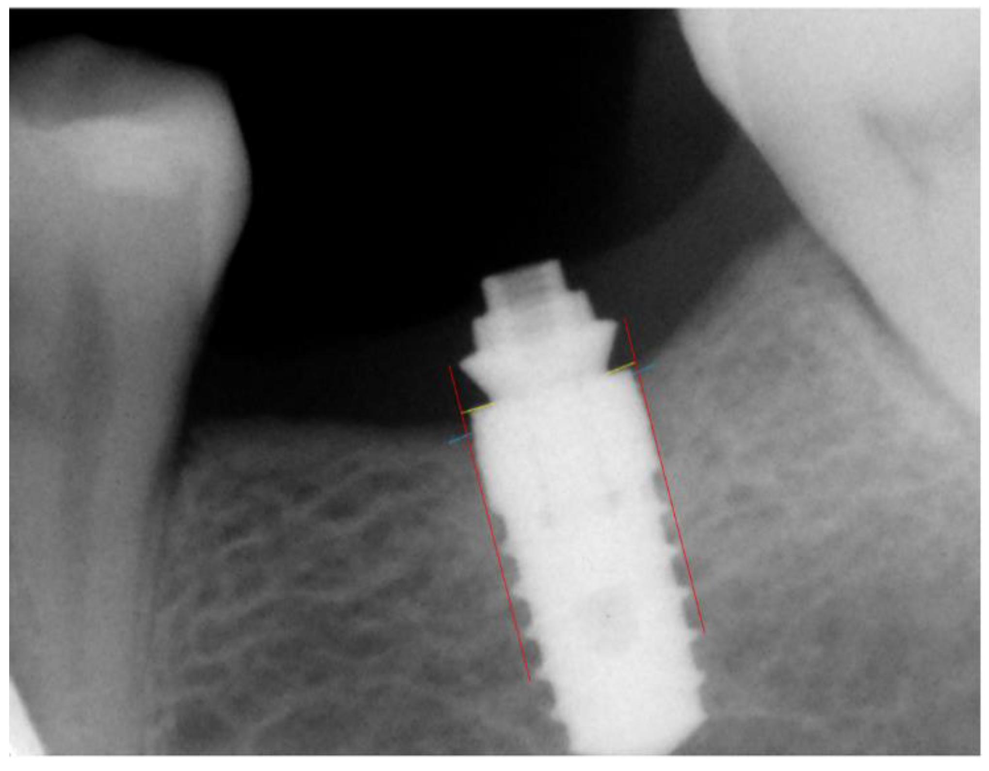 Materials 14 04179 g004