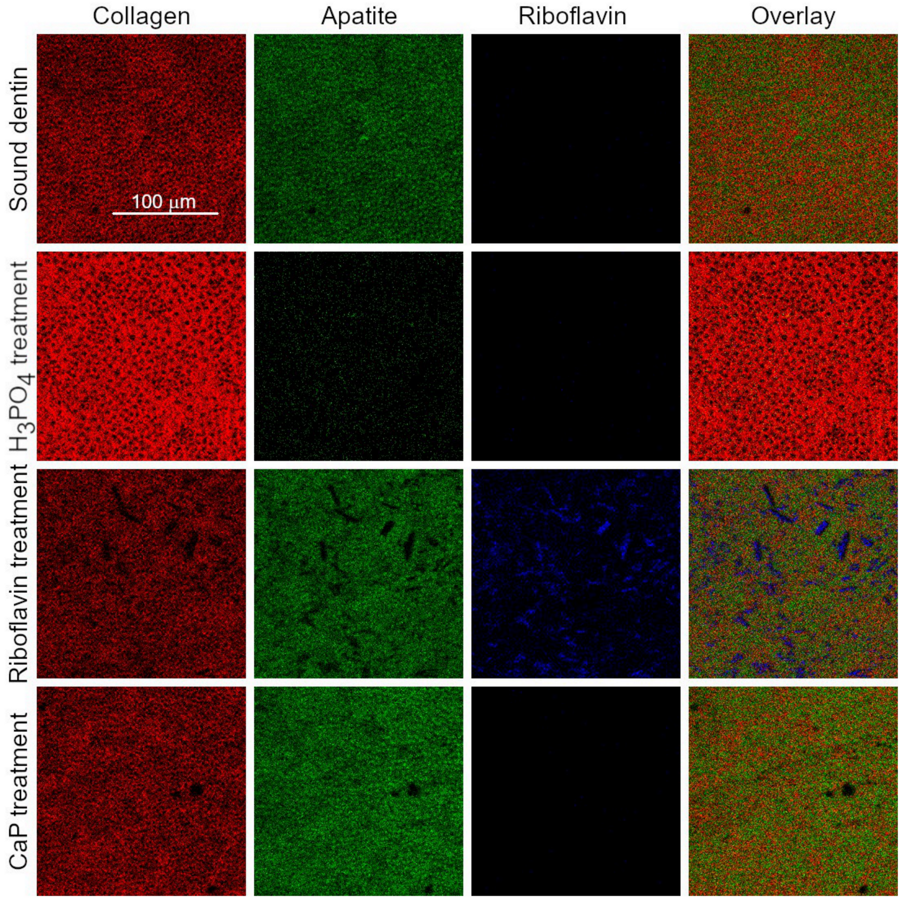 Materials 14 04535 g005