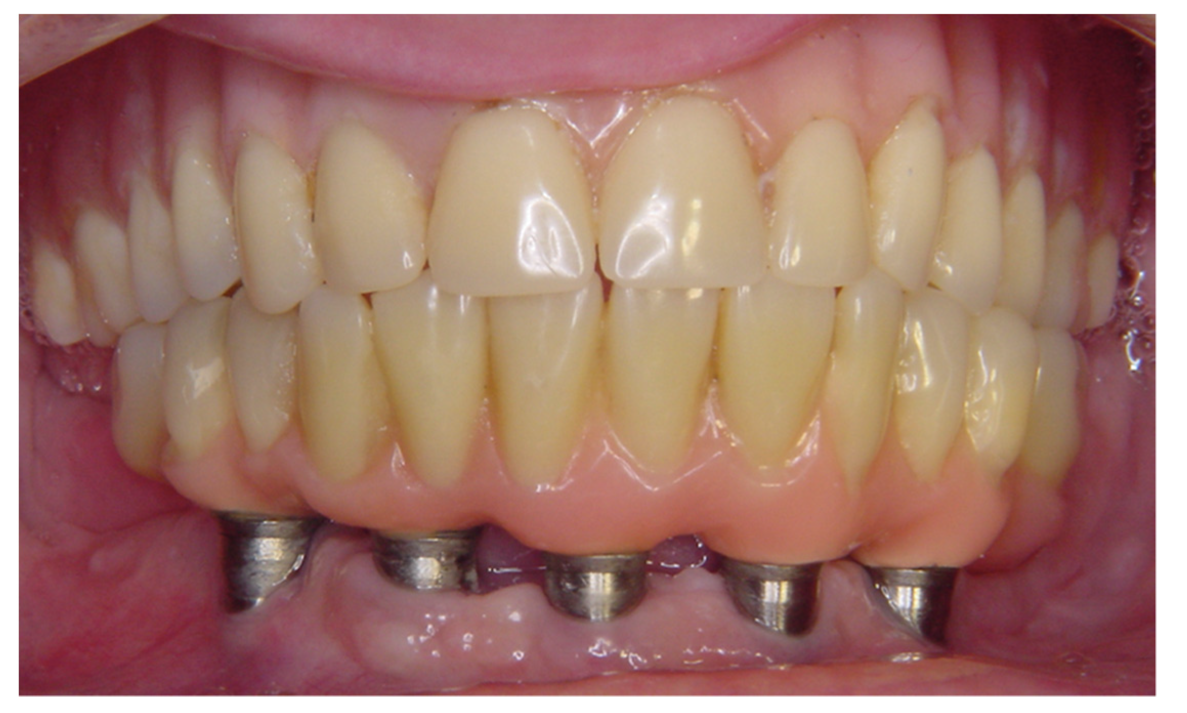 Materials 14 04644 g001