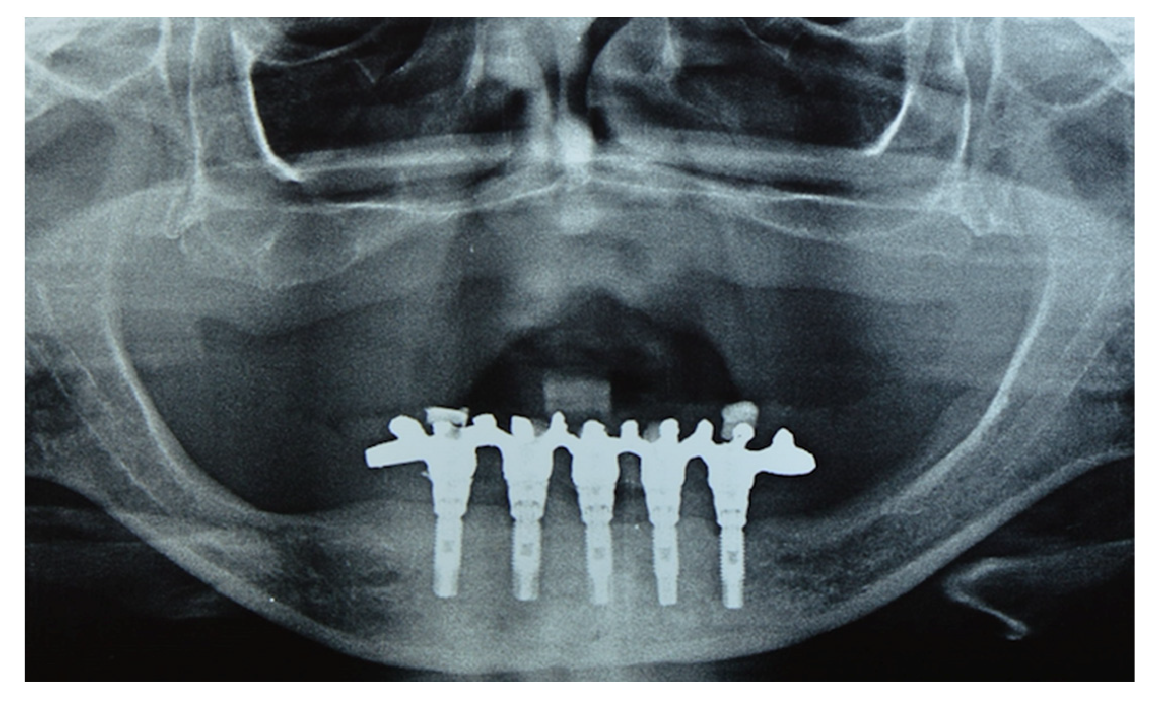 Materials 14 04644 g002