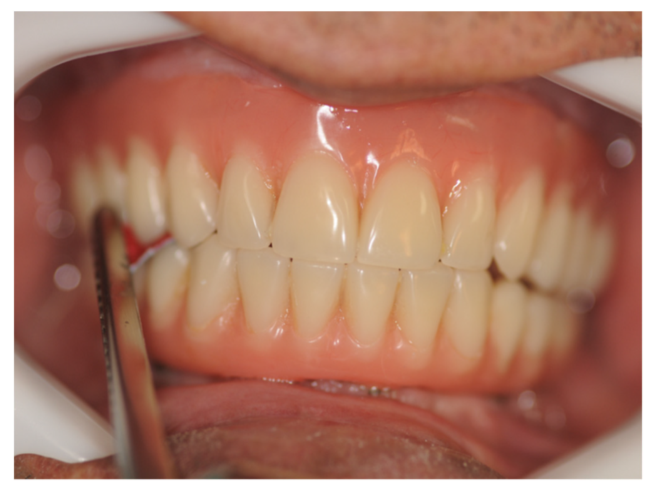 Materials 14 04644 g003