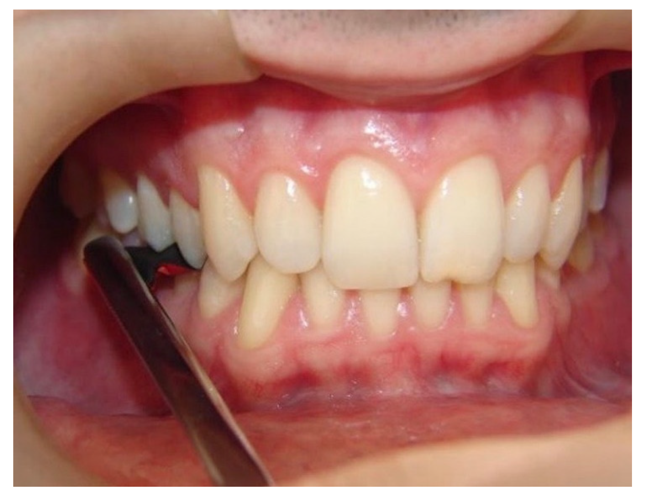 Materials 14 04644 g004