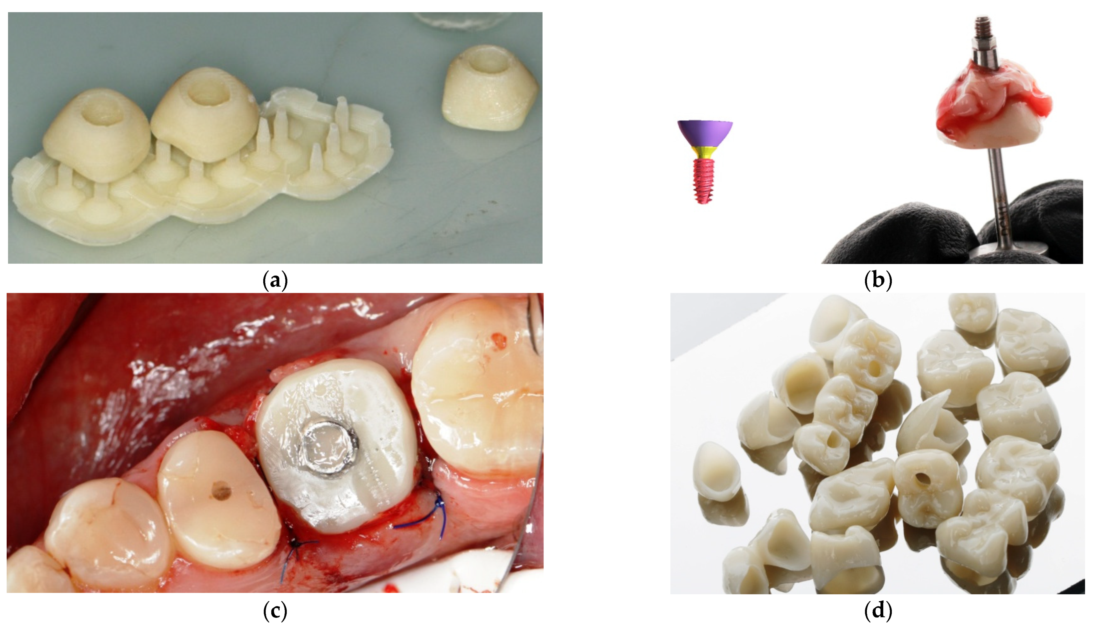 PDF) Influence of artificial aging: mechanical and physicochemical