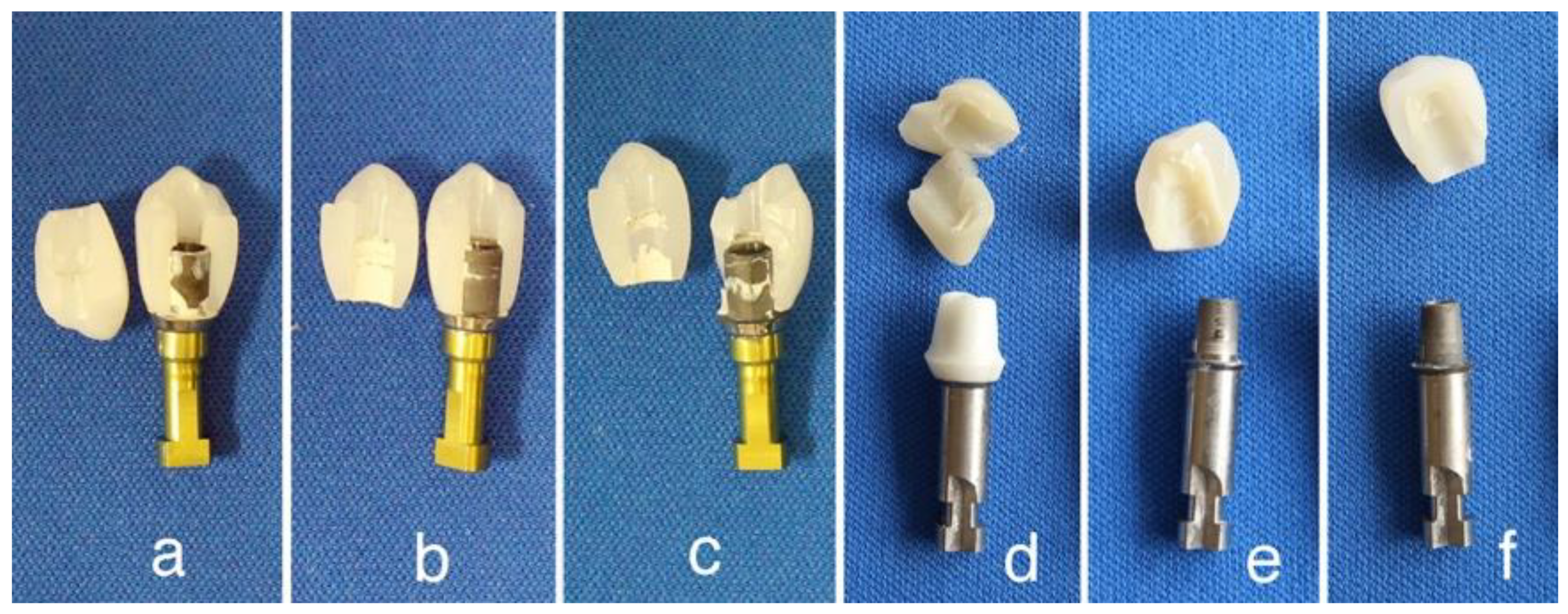 Materials 14 04879 g017