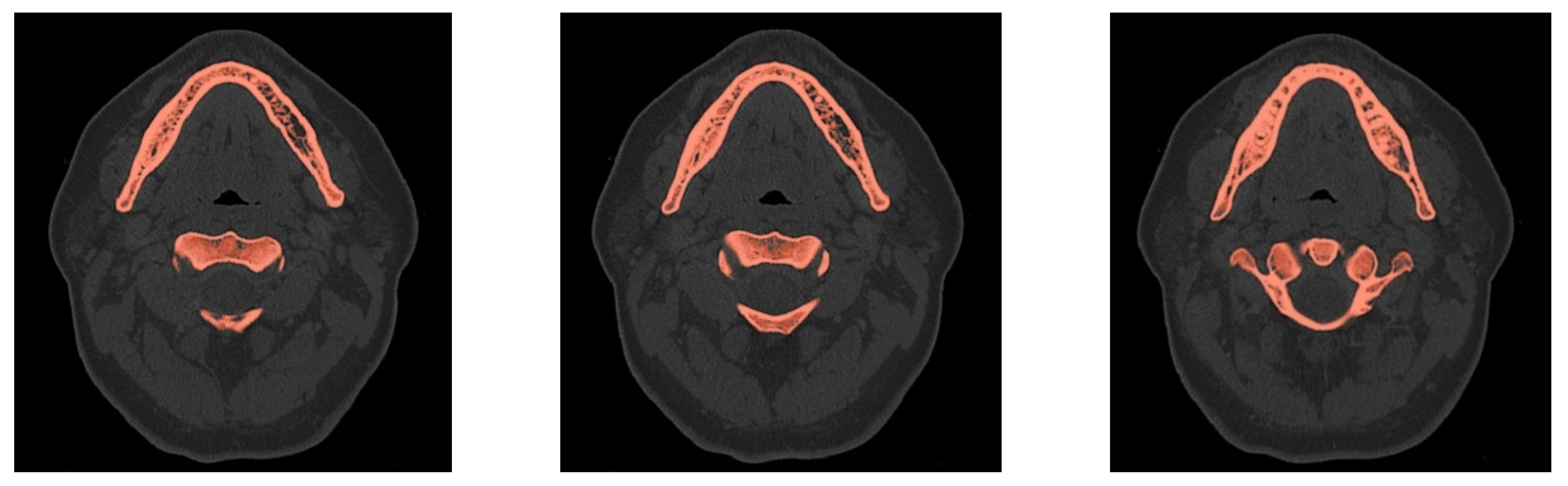 Materials 14 05031 g002 Materials 14 05031 g002