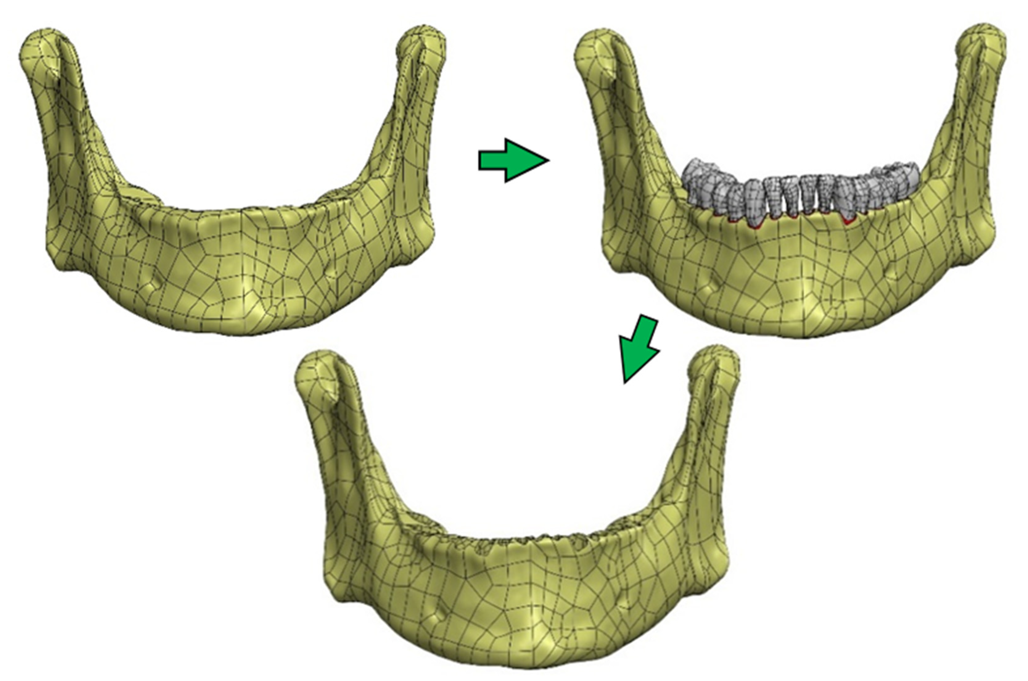 Materials 14 05031 g005 Materials 14 05031 g005