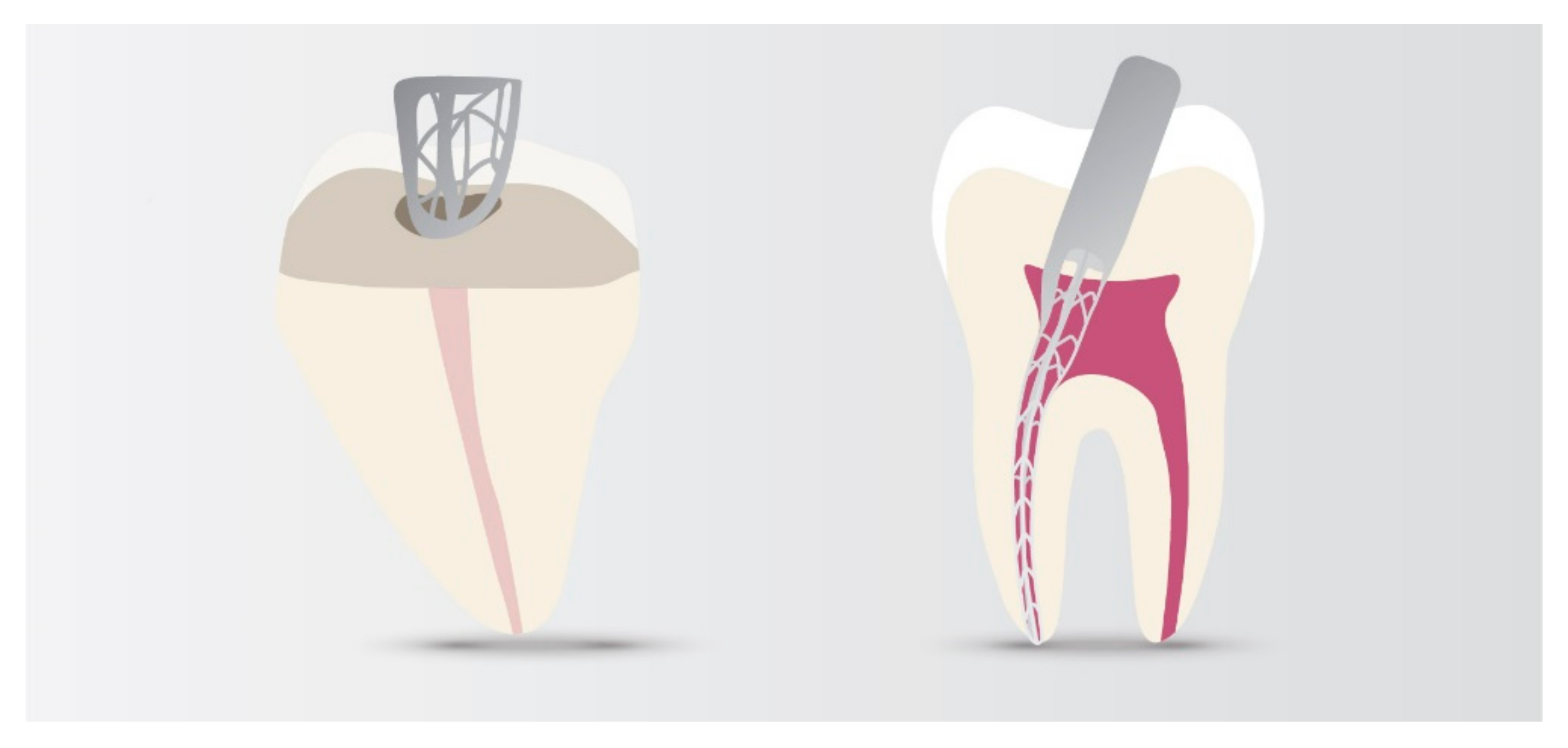 Materials 14 05296 g006