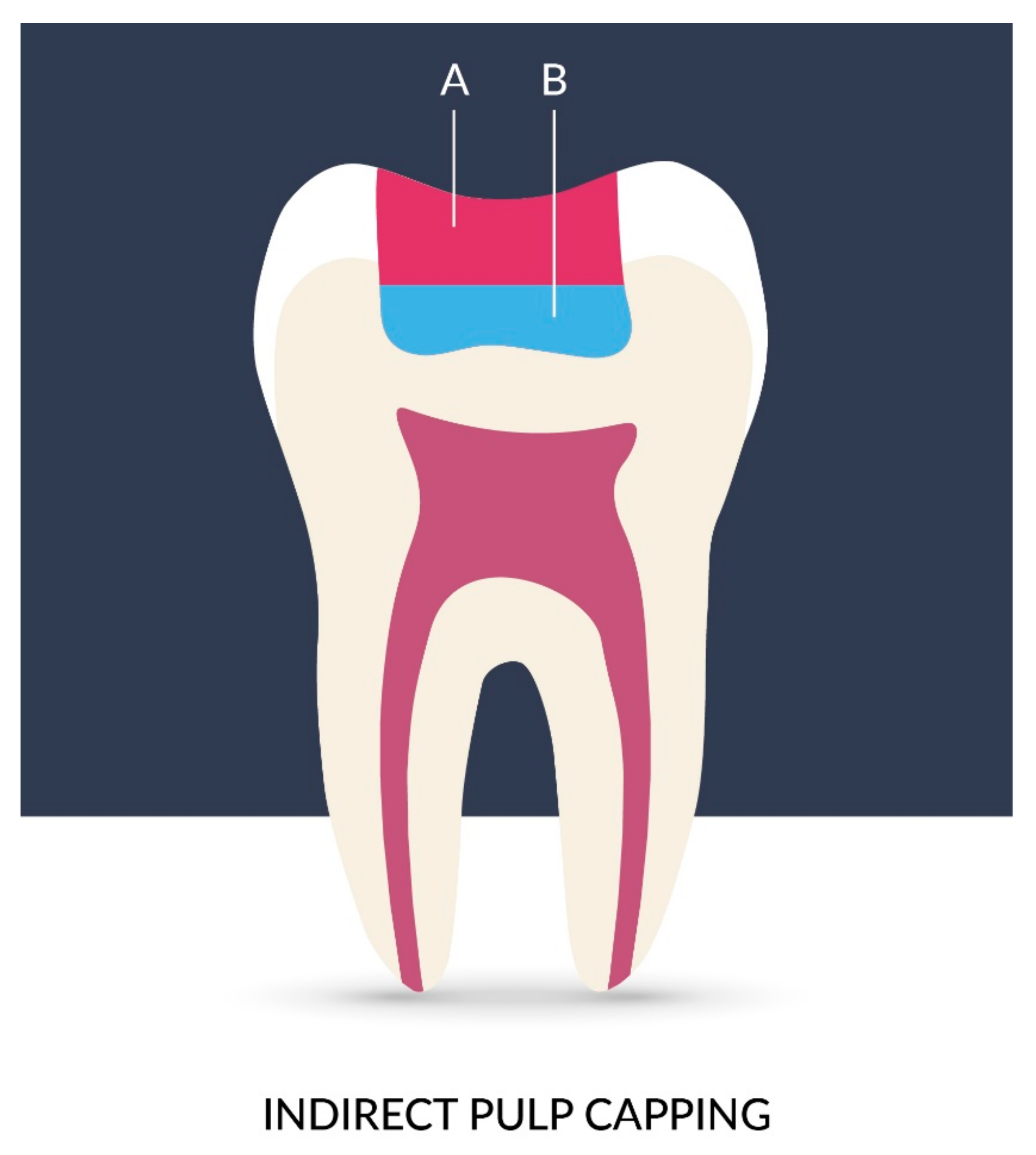 Materials 14 05296 g008