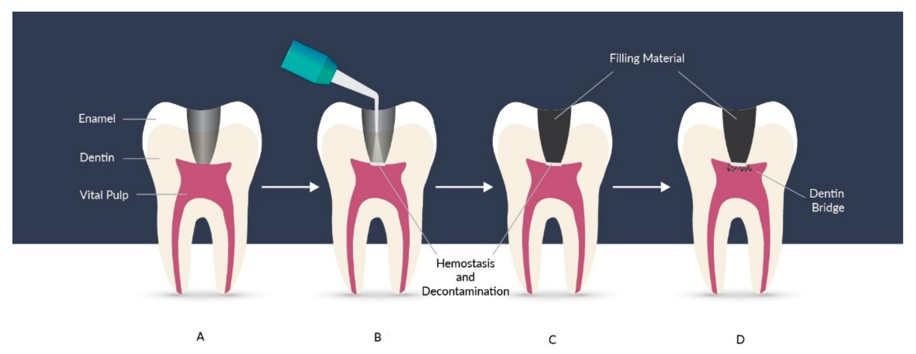 Materials 14 05296 g009