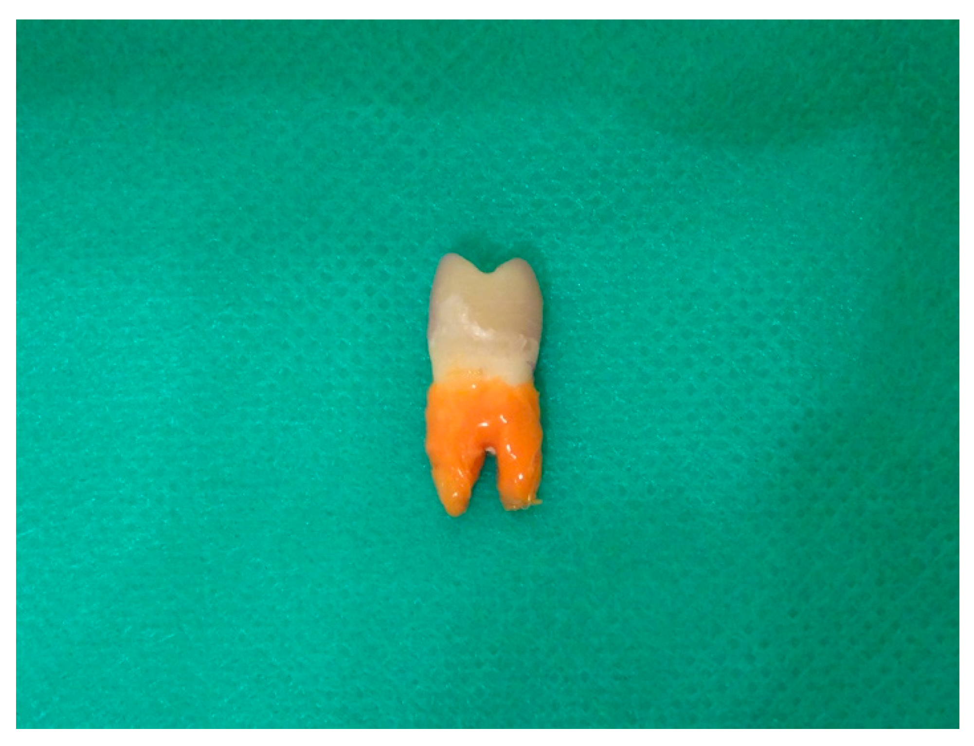 Materials 14 06214 g002