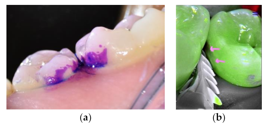 Materials 14 06272 g001