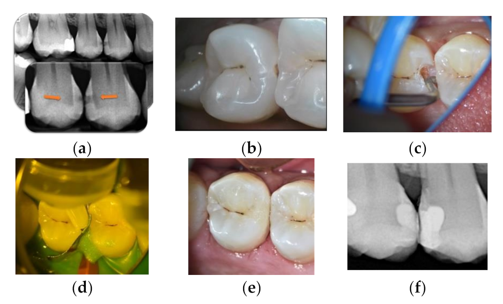 Materials 14 06272 g005