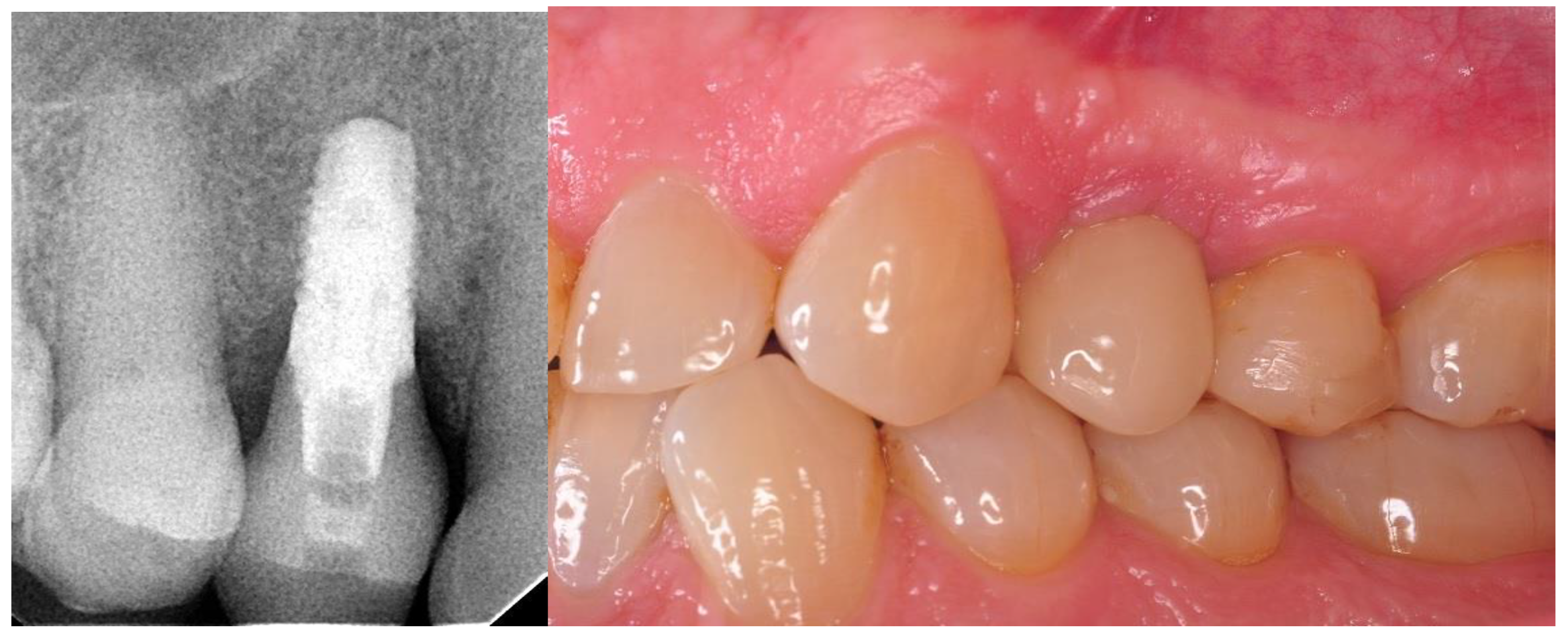 Materials 14 06353 g003