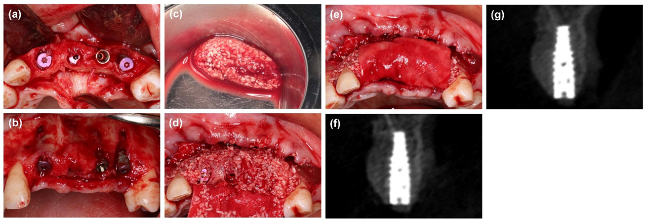 Materials 14 06430 g002 550