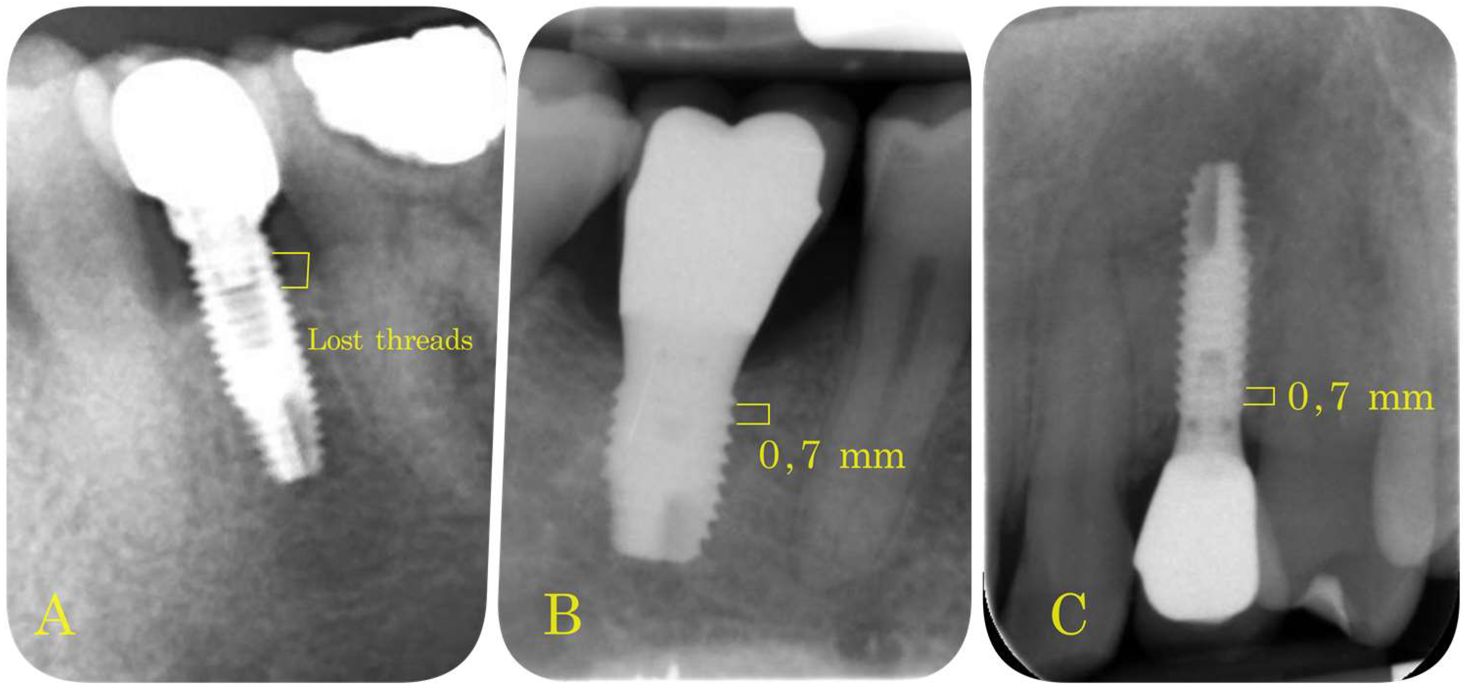 Materials 14 06483 g003