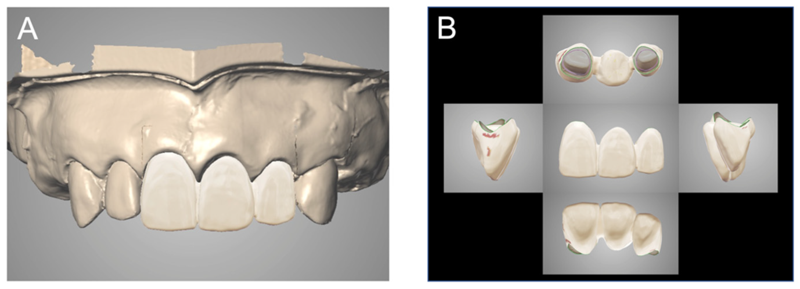 Materials 14 06489 g003