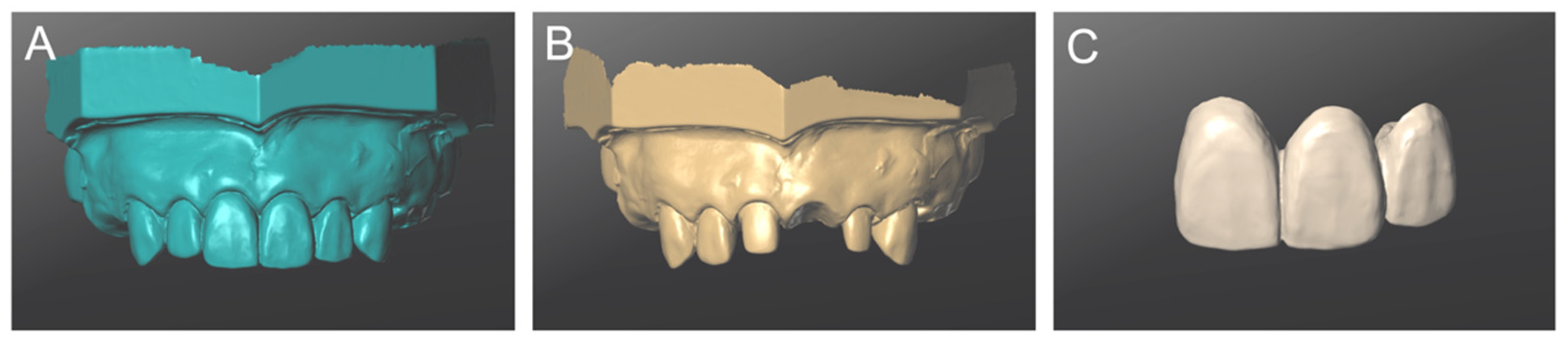 Materials 14 06489 g004