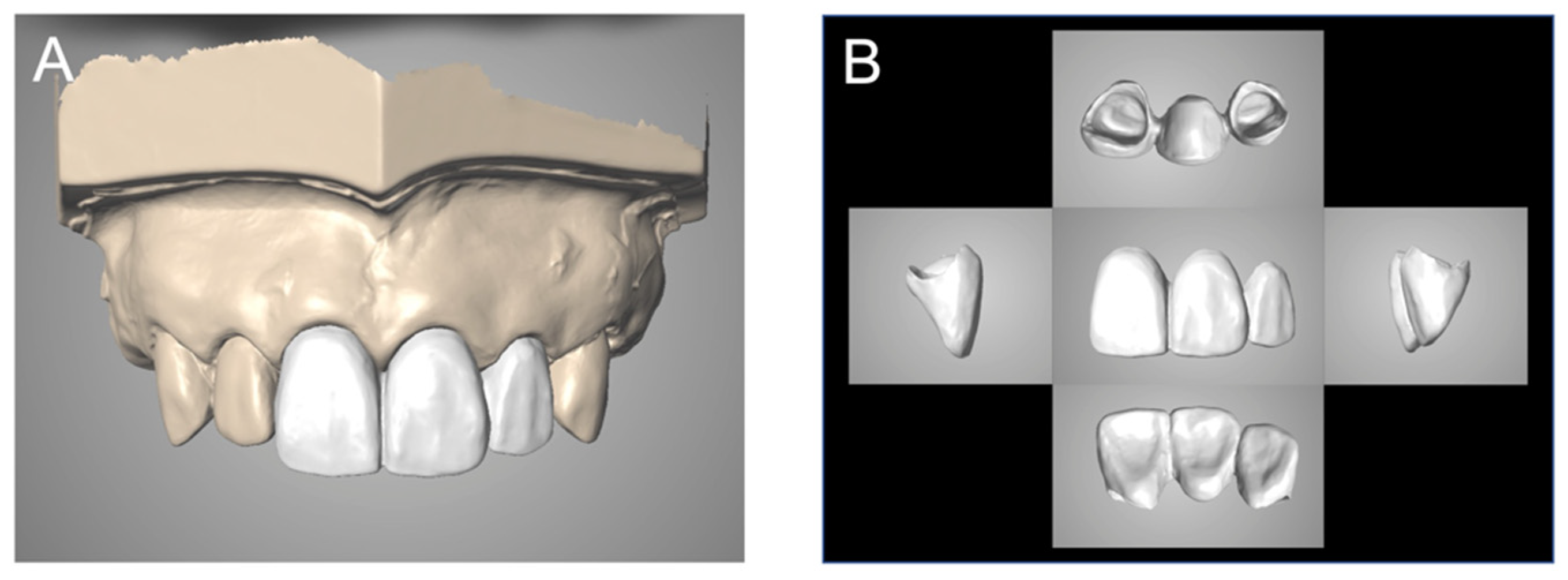 Materials 14 06489 g006