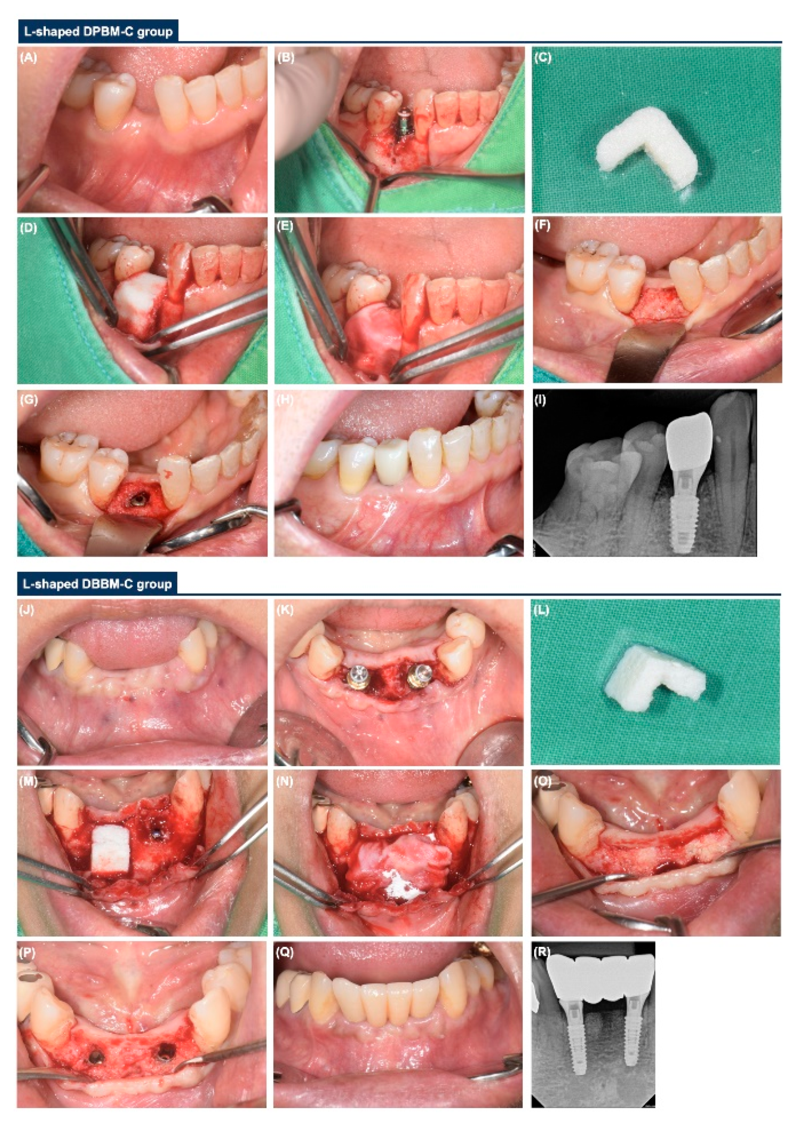 Materials 14 06580 g002 550