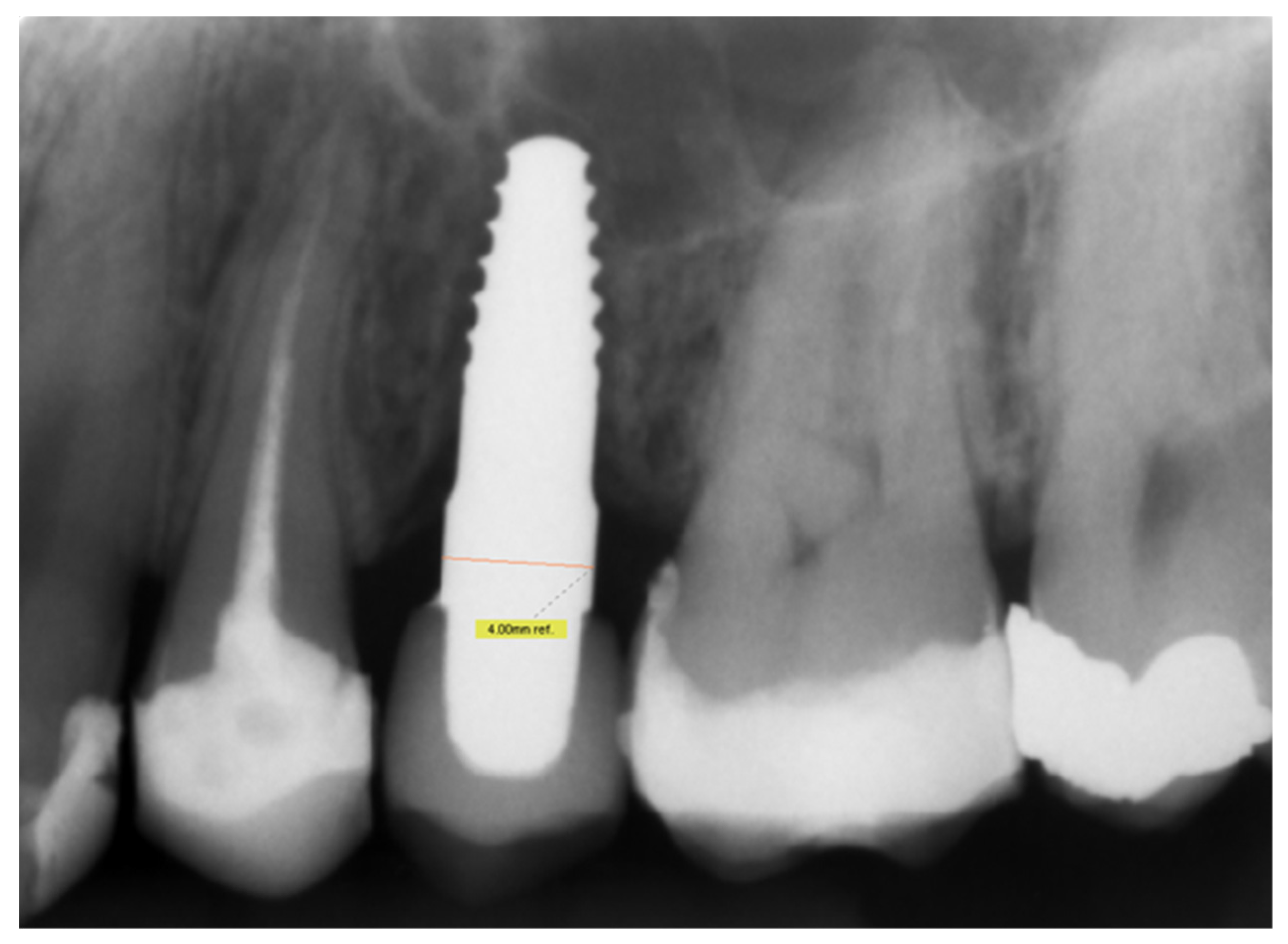 Materials 14 06738 g001 550