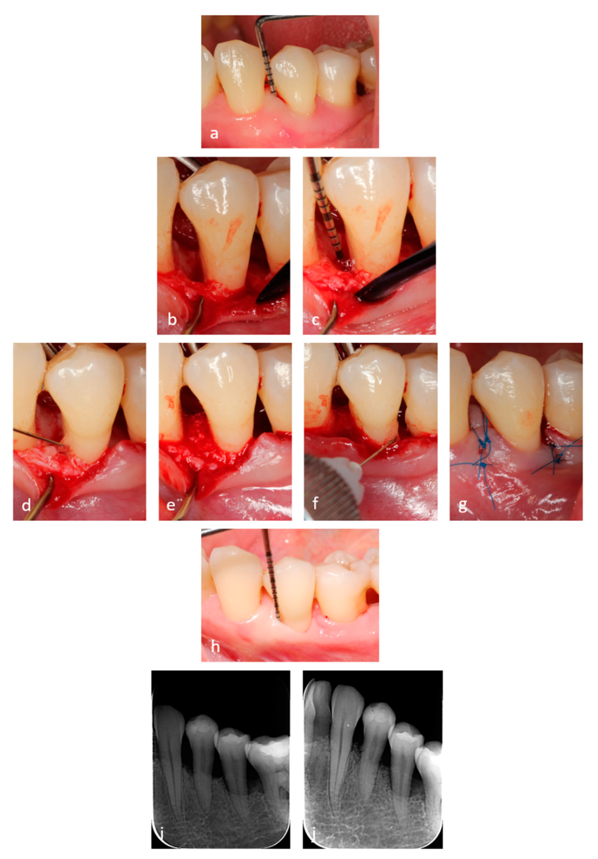 Materials 14 06795 g002 550