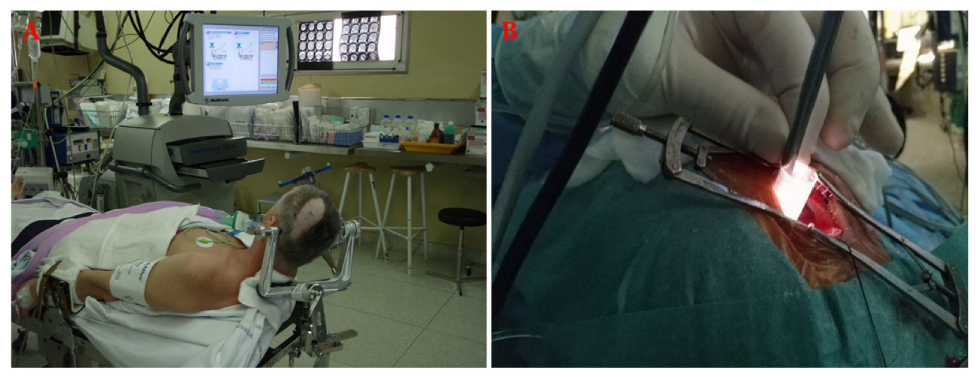 Materials 14 06857 g006 Materials 14 06857 g006