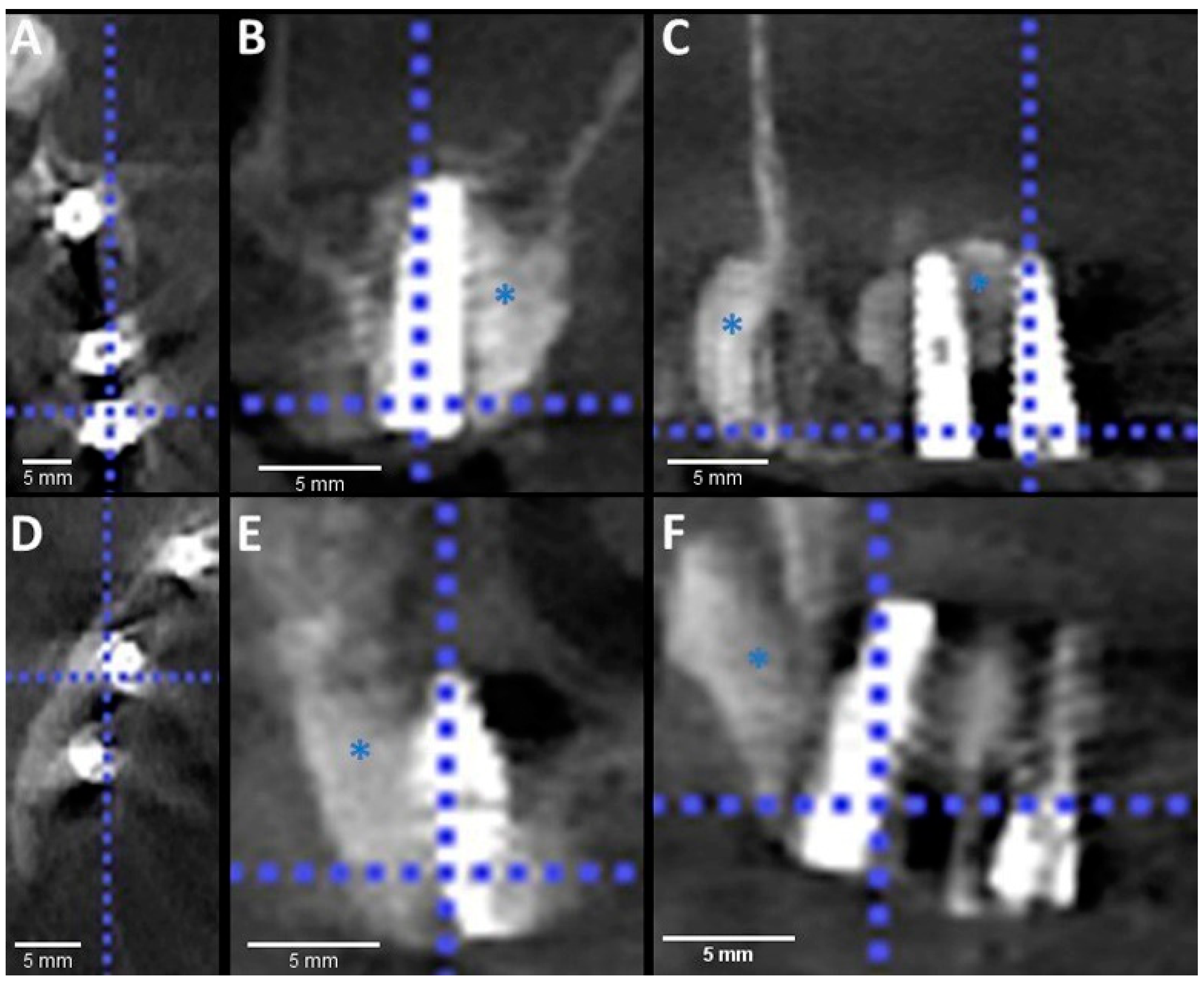 Materials 14 07084 g003