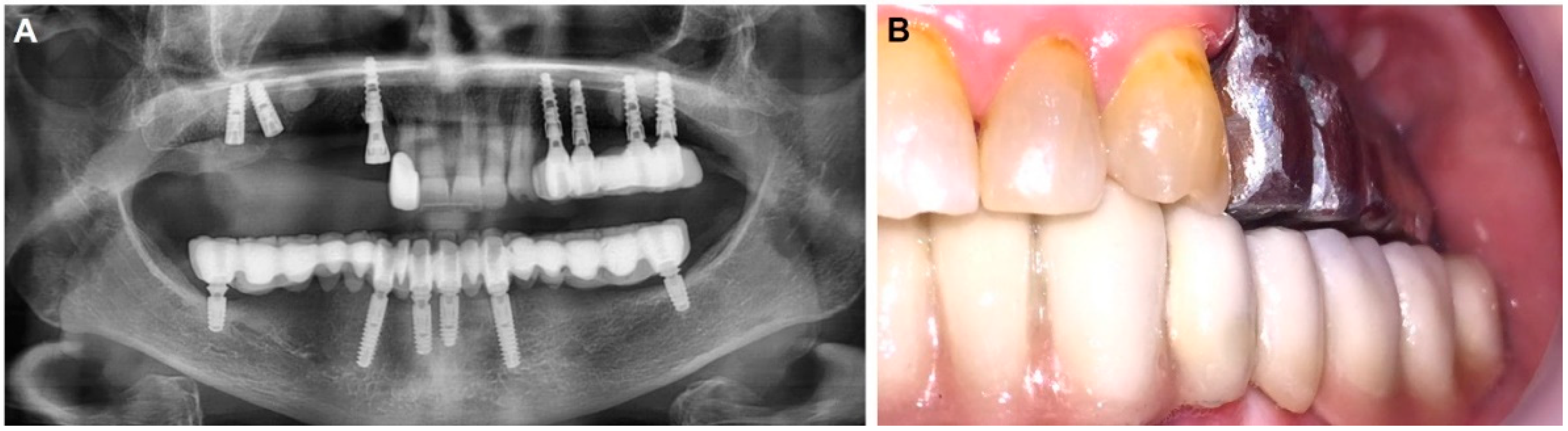 Materials 14 07084 g004