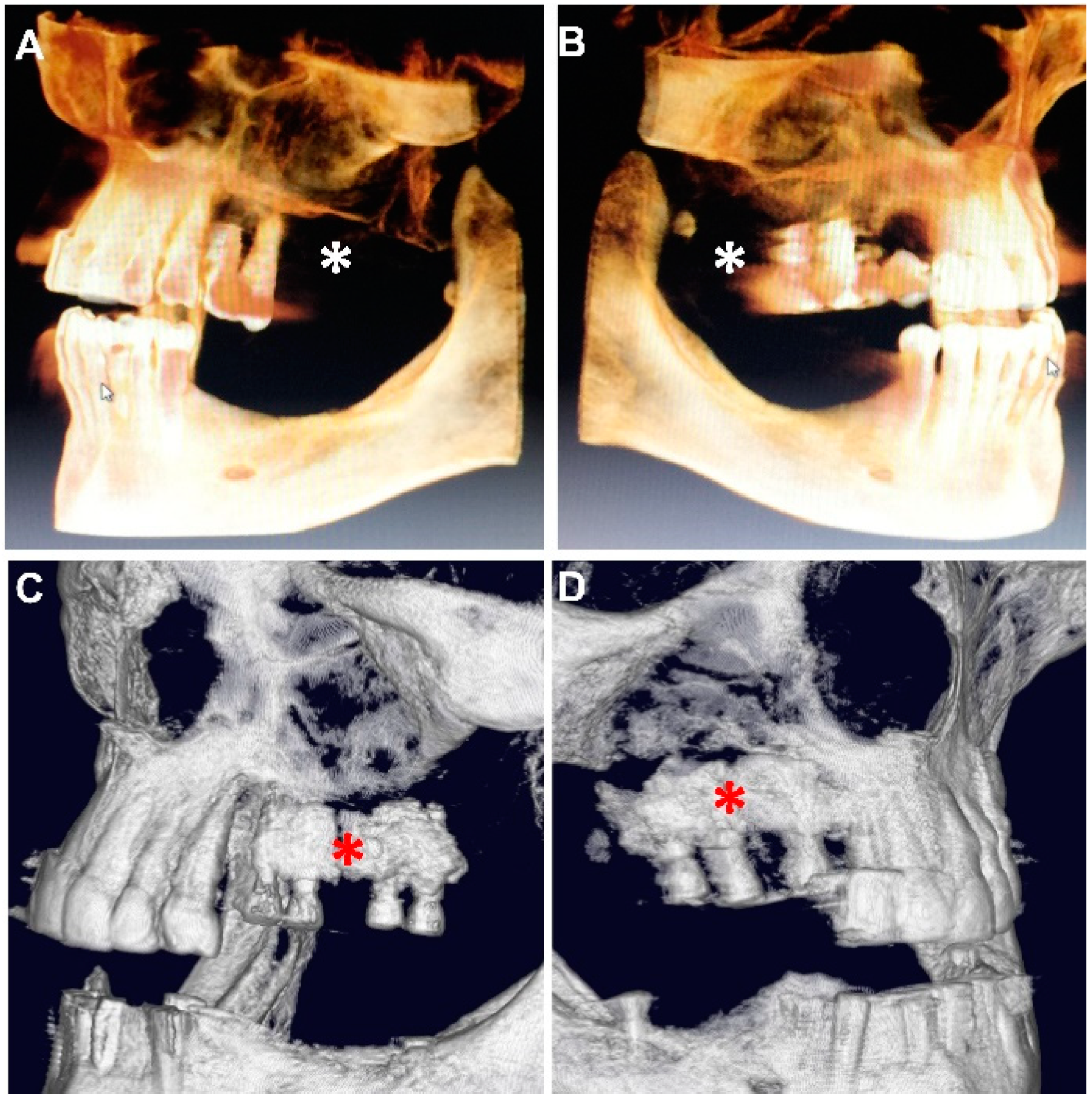 Materials 14 07084 g005