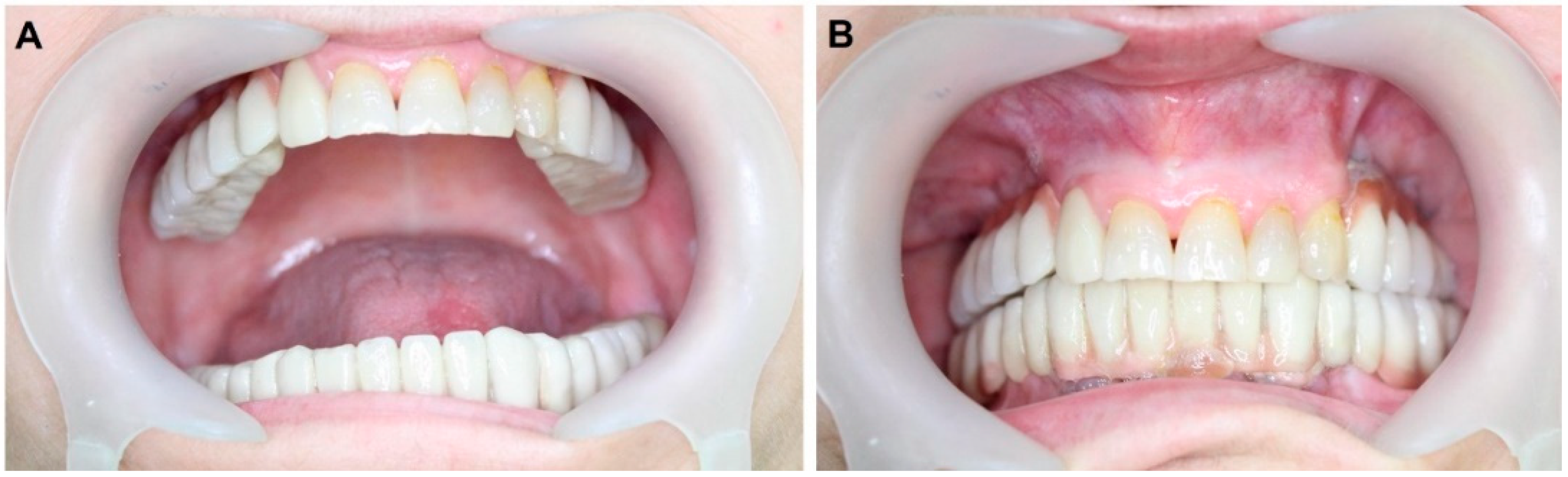 Materials 14 07084 g006
