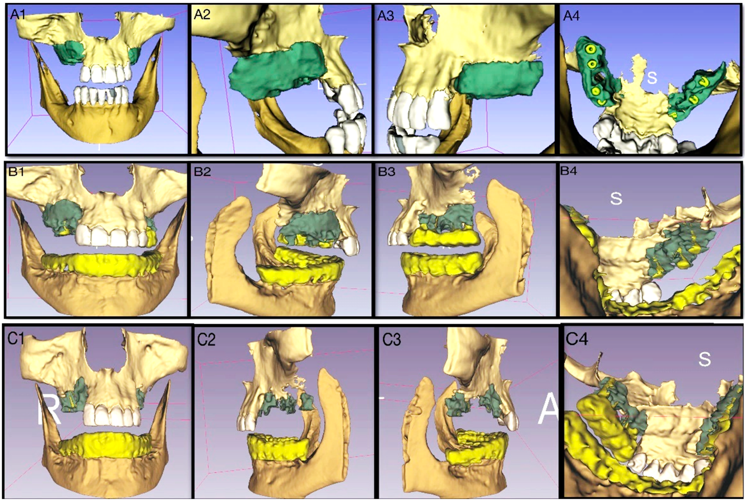 Materials 14 07084 g007