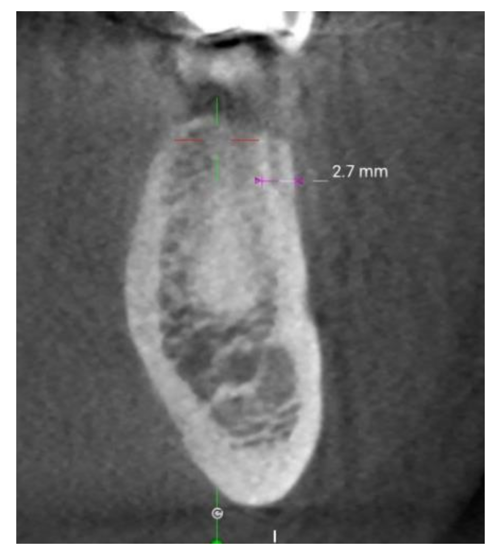 Materials 14 07183 g003 550