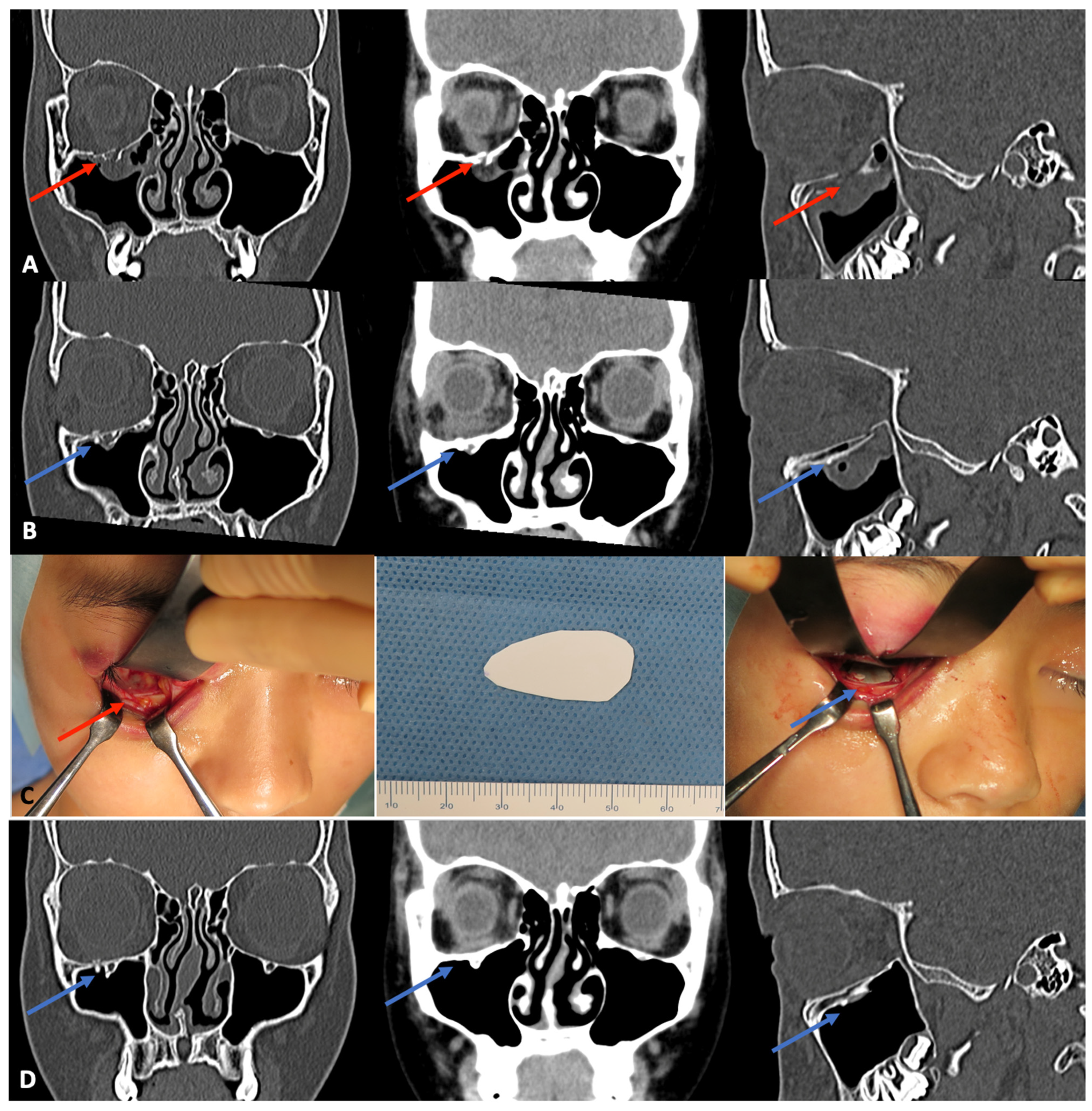 Materials 15 00150 g003