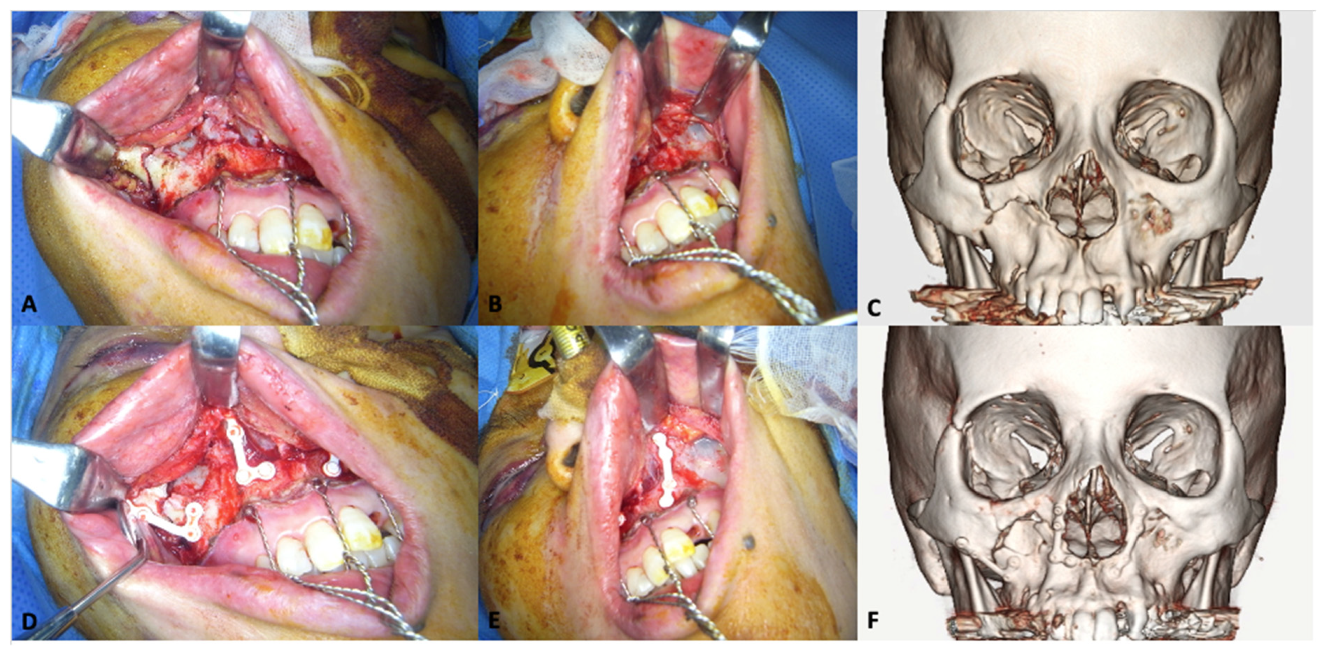 Materials 15 00150 g004