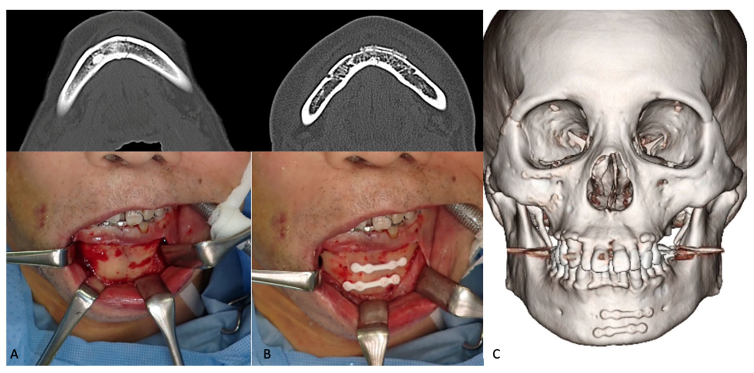 Materials 15 00150 g005