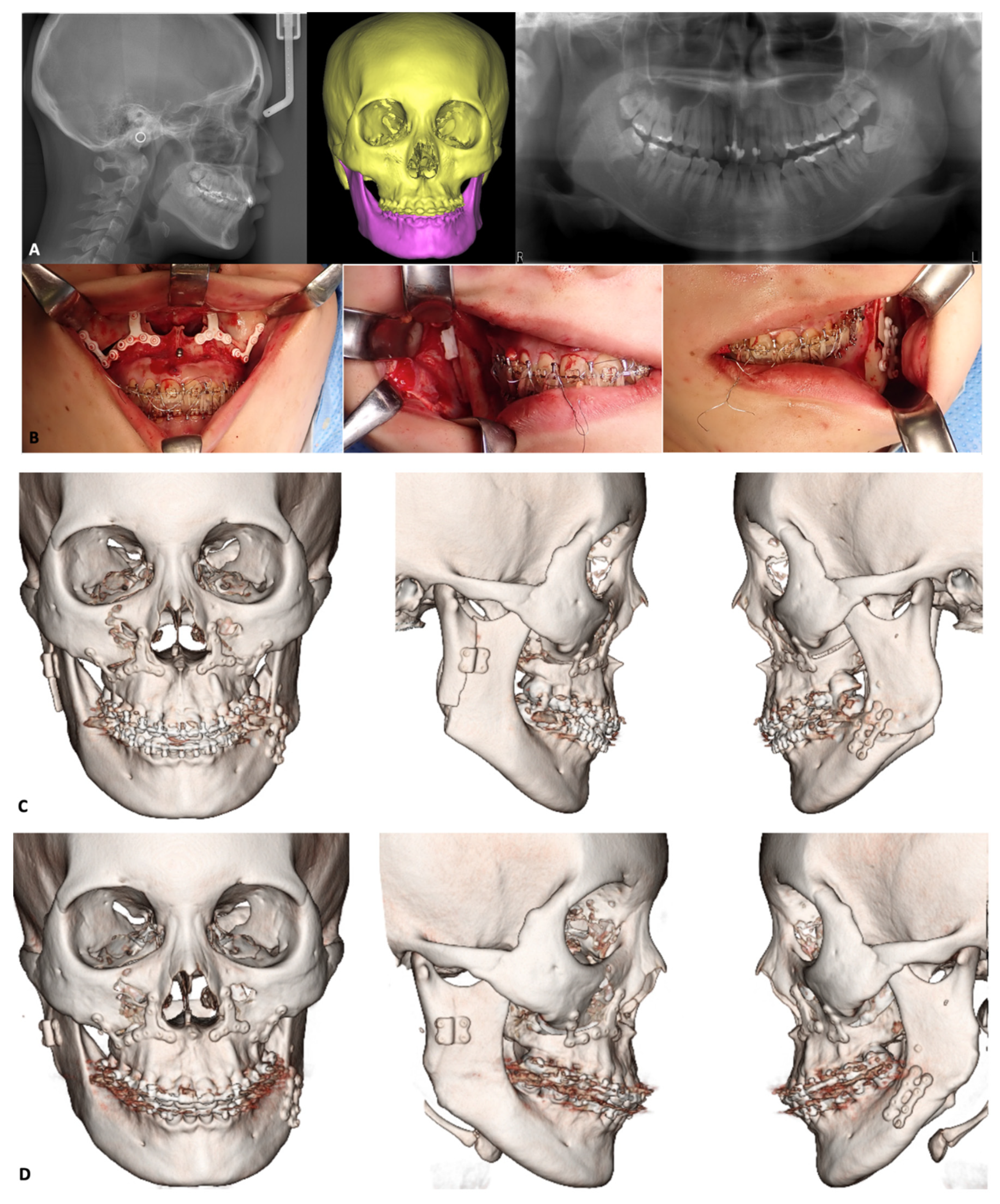 Materials 15 00150 g006