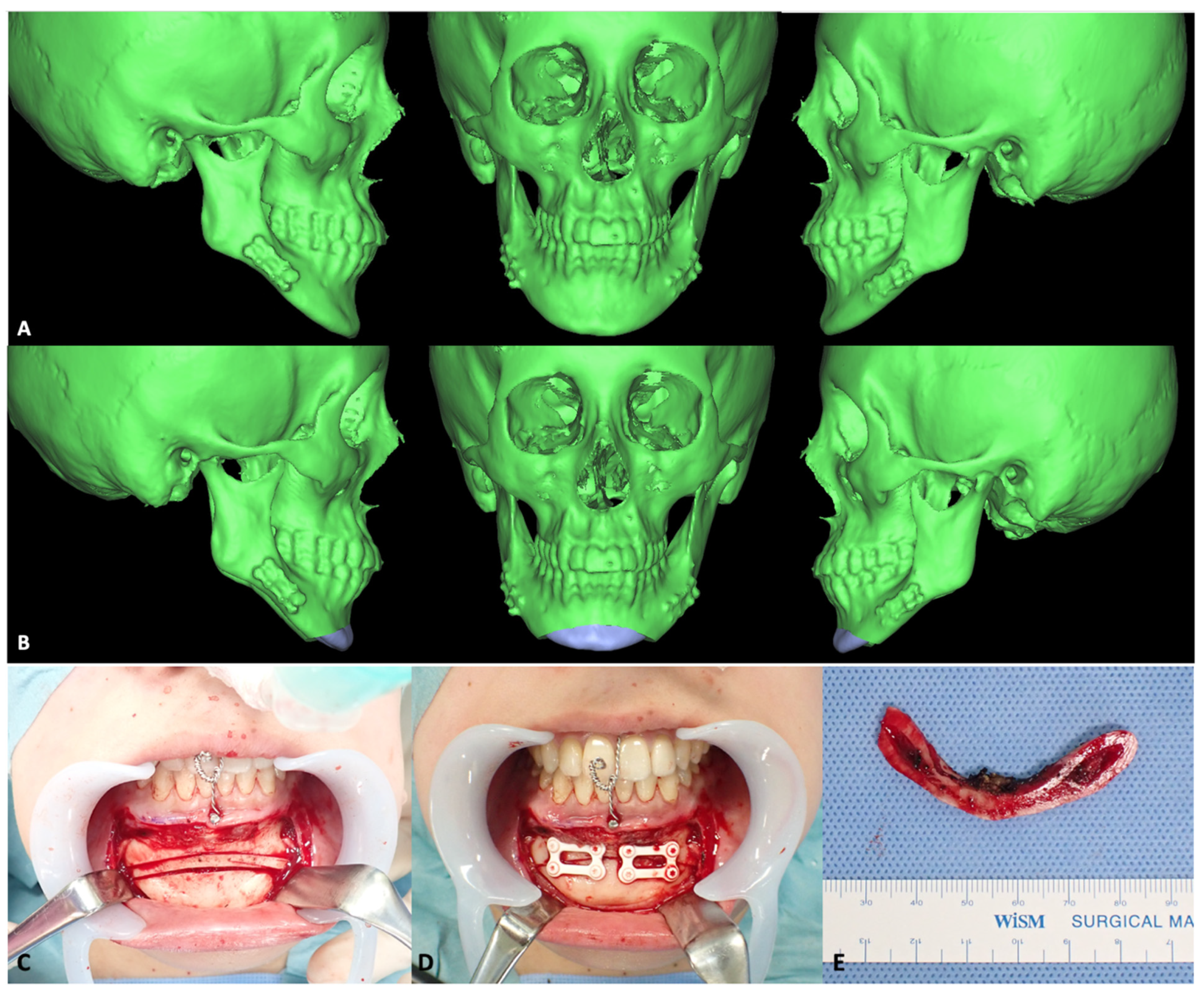 Materials 15 00150 g007a