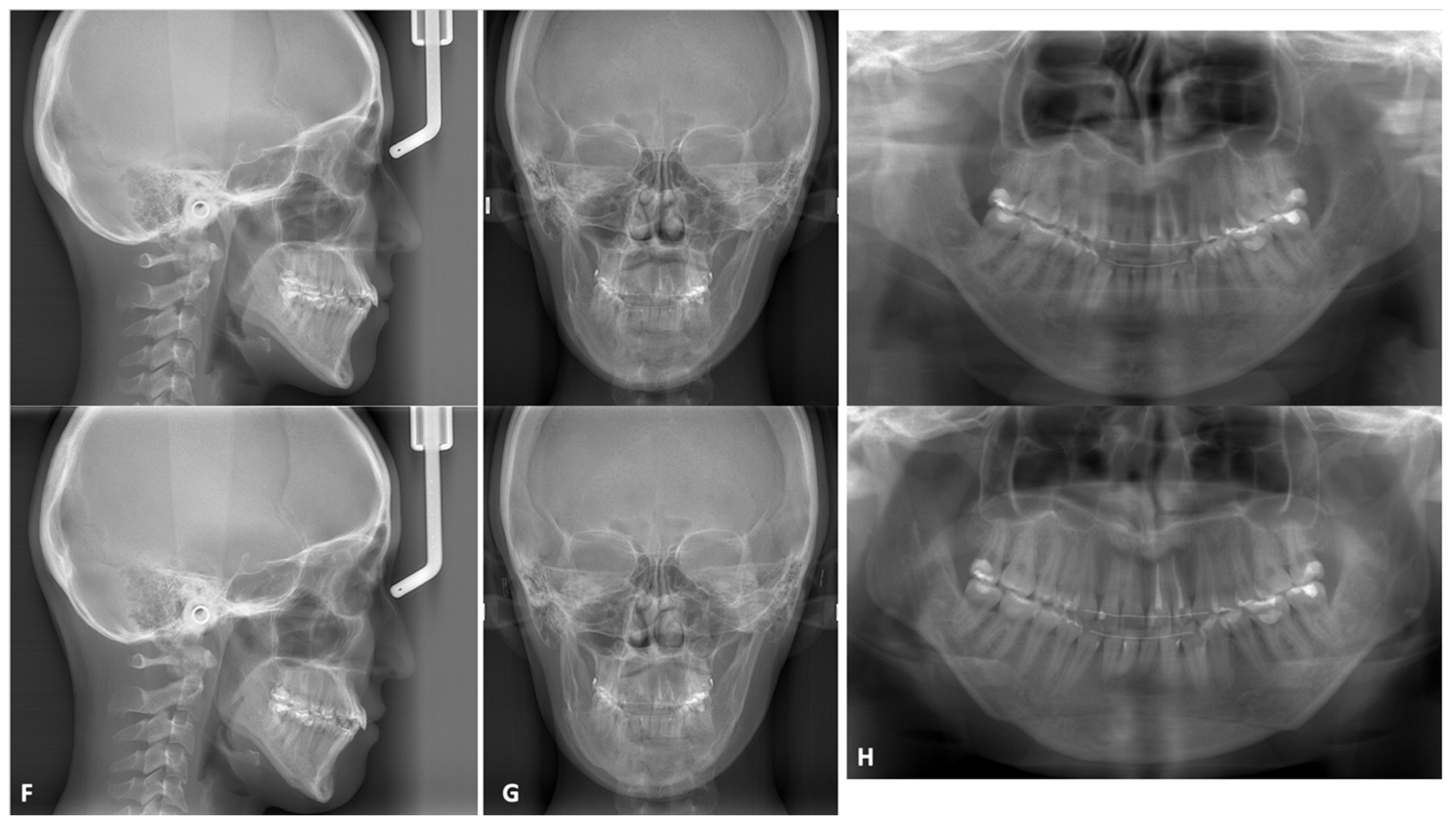 Materials 15 00150 g007b