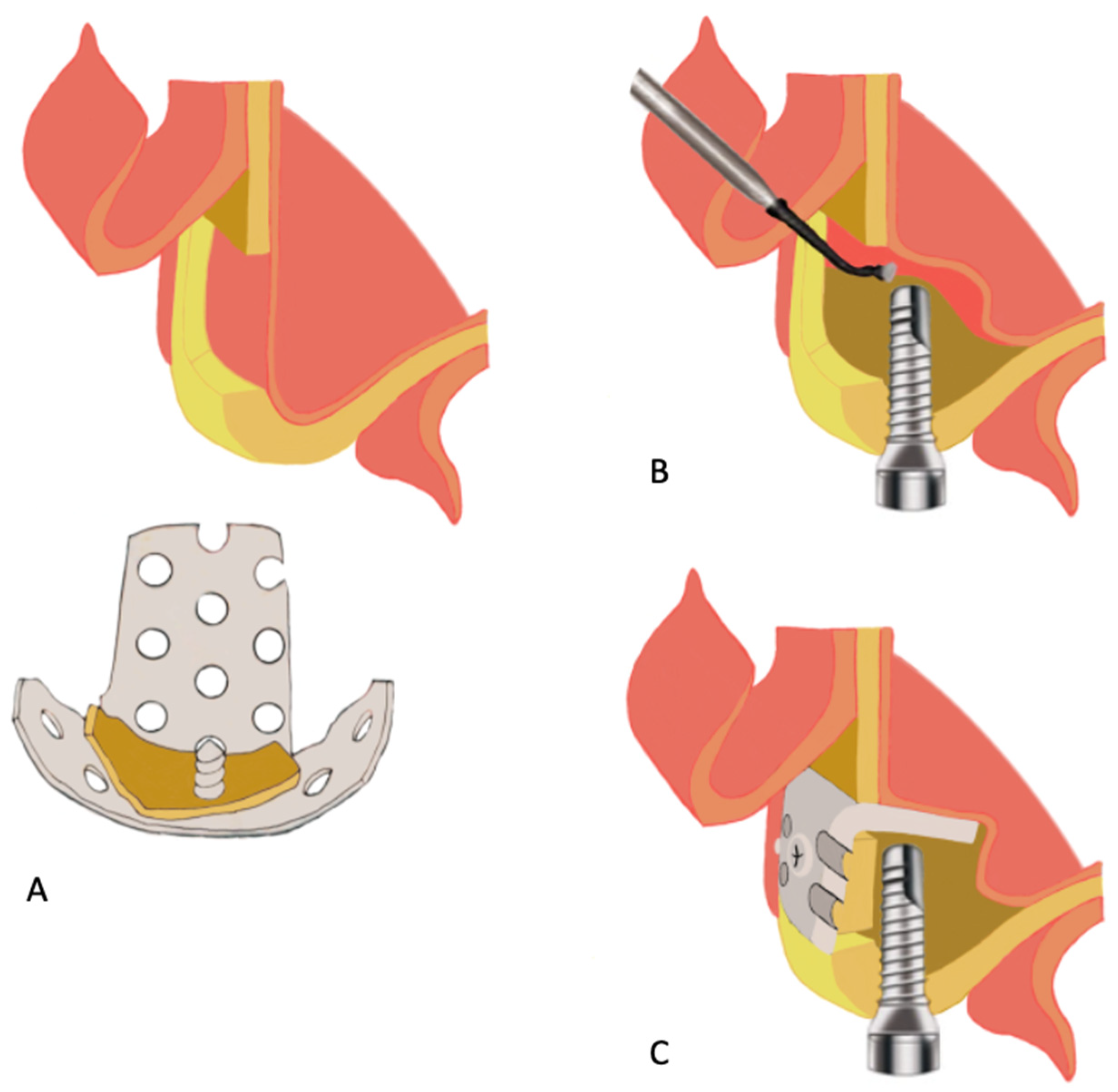 Materials 15 00150 g008