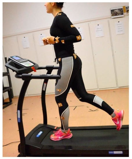 Adaptive exercise: When medical compression garments get in the way of  working out (Guest Post) – FIT IS A FEMINIST ISSUE